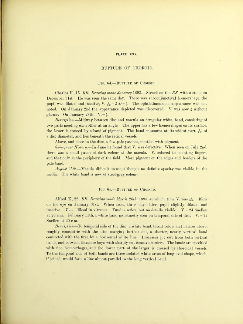 RUPTURE OF CHOROID. Fig. 64.—Rupture of Choroid. Charles H., 15. RE. Drawing made January 1893.—Struck on the RE. with a stone on December 31st. He was seen the same day. There was subconjunctival haemorrhage, the pupil was dilated and inactive, Y. Ti% - 2 D = %. The ophthalmoscopic appearance was not noted. On January 2nd the appearance depicted was discovered. V. was now £ without glasses. On January 28th—Y. =£. Description.—Midway between disc and macula an irregular white band, consisting of two parts meeting each other at an angle. The upper has a few haemorrhages on its surface, the lower is crossed by a band of pigment. The band measures at its widest part jV of a disc diameter, and lies beneath the retinal vessels. Above, and close to the disc, a few pale patches, mottled with pigment. Subsequent History.—In June he found that V. was defective. When seen on July 2nd, there was a small patch of dark colour at the macula. V. reduced to counting lingers, and that only at the periphery of the field. More pigment on the edges and borders of the pale band. August 25th.—Macula difficult to see, although no definite opacity was visible in the media. The white band is now of steel-grey colour. Fig. 65.—Rupture of Choroid. Alfred E., 22. RE. Drawing made March 26th, 1893, at which time V. was /£. Blow on the eye on January 31st. When seen, three days later, pupil slightly dilated and inactive. T~. Blood in vitreous. Fundus reflex, but no details, visible. V. = 24 Snellen at 20 c.m. February lltli, a white band indistinctly seen on temporal side of disc. Y. = 12 Snellen at 20 c.m. Description—To temporal side of the disc, a white band, broad below and narrow above, roughly concentric with the disc margin; further out, a shorter, nearly vertical band connected with the first by a horizontal white line. Processes jut out from both vertical bands, and between these are bays with sharply-cut concave borders. The bands are speckled with fine lnemorrhages, and the lower part of the larger is crossed by choroidal vessels. To the temporal side of both bands are three isolated white areas of long oval shape, which, if joined, would form a line almost parallel to the long vertical band.