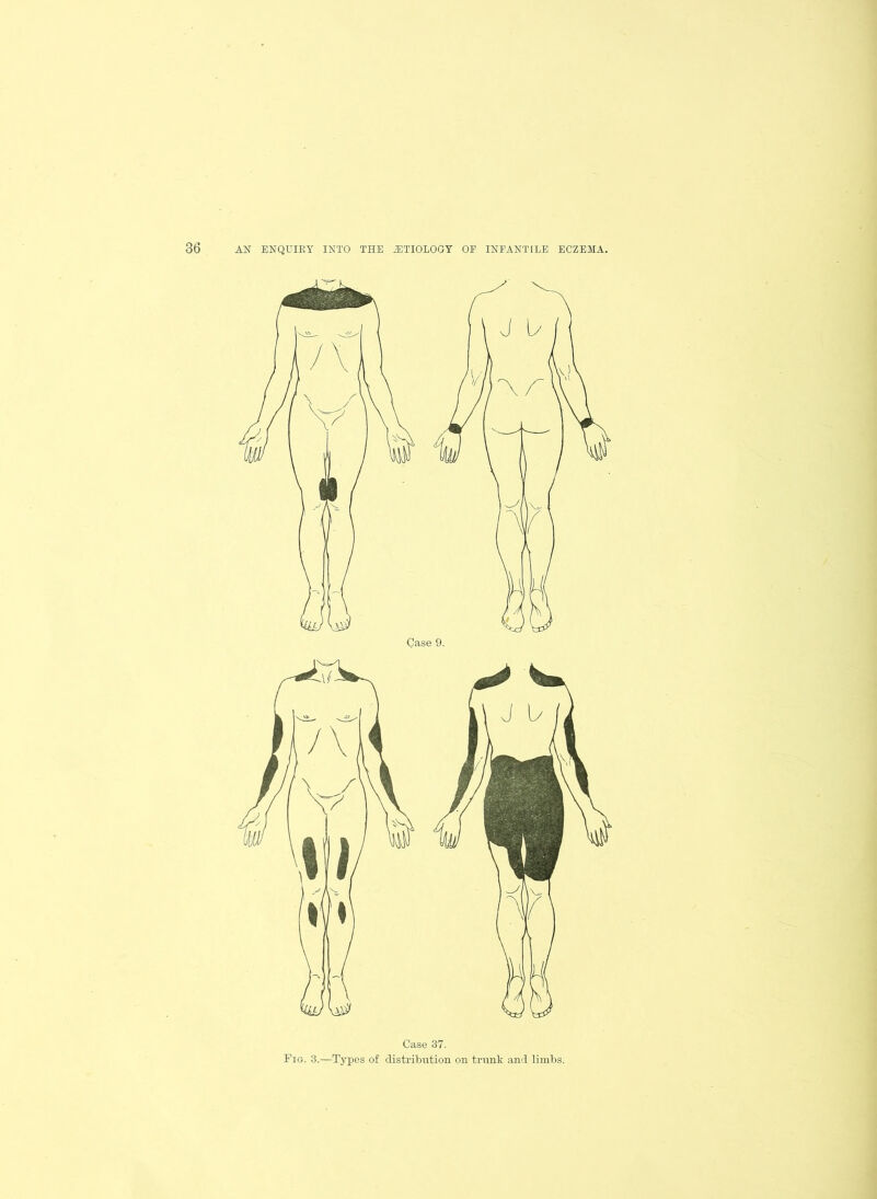 Case 37- Fig. 3.—Types of distribution on trunk and limbs.