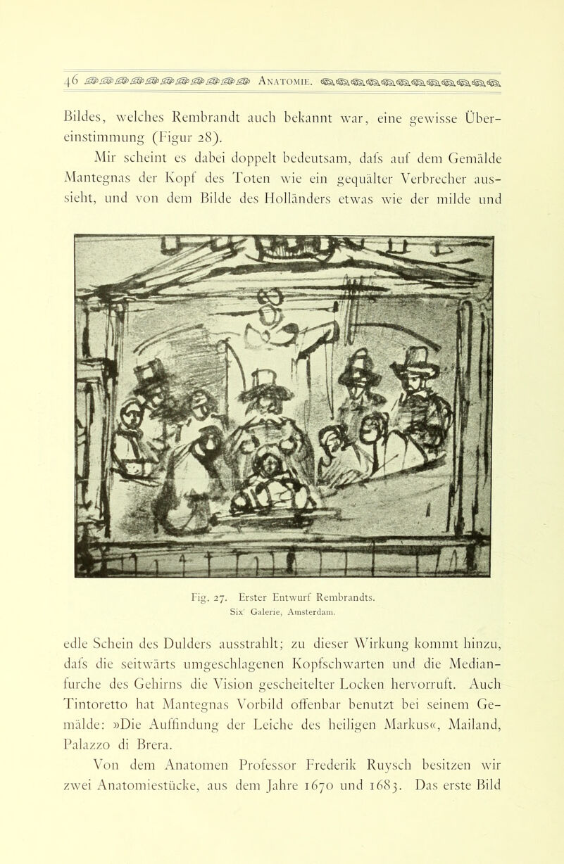 J3ildes, welches Rembrandt auch bekannt war, eine gewisse Über- einstimmung (Figur 28). xMir scheint es dabei doppelt bedeutsam, dafs auf dem Gemälde Mantegnas der Kopl des Toten wie ein gequälter Verbrecher aus- siebt, und von dem Bilde des Holländers etwas wie der milde und Fig. 27. Erster Entwurf Rembrandts. Six' Galerie, Amsterdam. edle Schein des Dulders ausstrablt; zu dieser Wirkung kommt hinzu, dals die seitwärts umgescblagenen Kopfscbwarten und die Median- lurcbe des Gehirns die Vision gescheitelter Locken hervorrult. Auch Tintoretto hat Mantegnas Vorbild offenbar benutzt hei seinem Ge- mälde: »Die Aulfindung der Leiche des heiligen Markus«, Mailand, Palazzo di Brera. Wn dem Anatomen Professor Frederik Ruysch besitzen wir zwei Anatomiestücke, aus dem Jahre 1670 und 1683. Das erste Bild