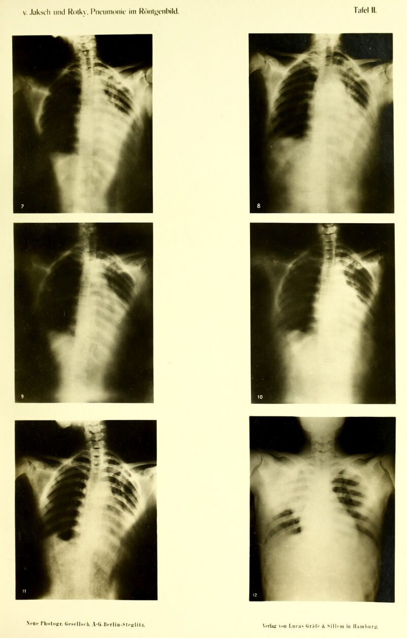 V. Jilksch uikI Rolkv. I’nciimoiiio iin RöiitjL;i‘ttl)ikl. Ni'nc riii>t<i);r. lii'si'llsrii. A-(i. Bi-rliii-Str^lil/. ViTliiu \iiM l.iic;i> lirrili' \ >illi'iii in H;i in Im r^'.