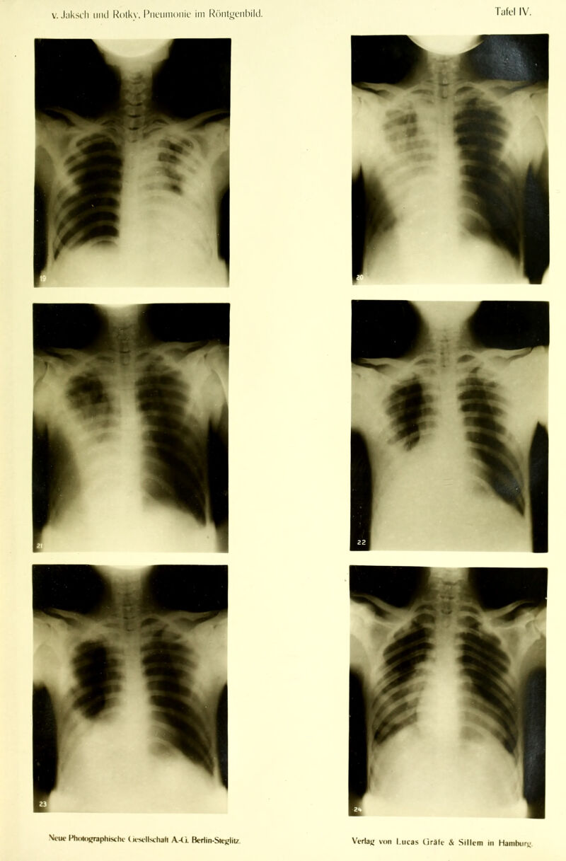 Tiifcl IV. Ni-ue Ph.mnrraphischc (a-st-llschafi A-(i. Beriin-Siejrlit/. Verla« von l.ucas C]räfe & Sillem in Hambur«