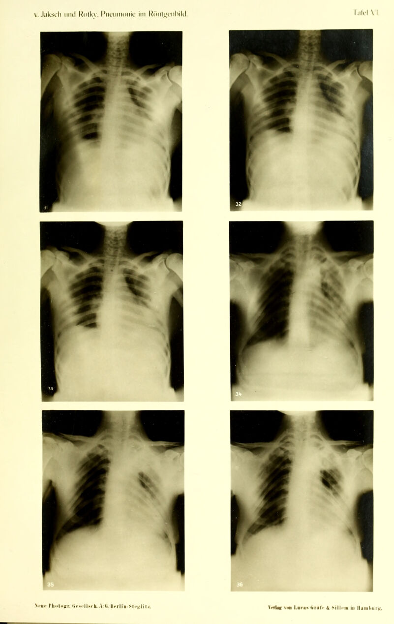 «•Hl l.ura« liriTi' \ >ill>-iii in llaiiilnir);.