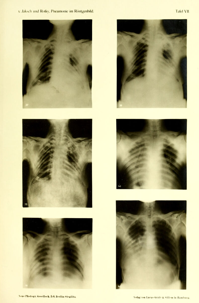 Ni-ui- rhofiiirr. tifsflUrh. A:<i. ll•■rlill-Sll'){lil/. \iTla!j \i>ii l.iK-a' •iraf'- >ill.'iii in lla inl>nr;jr.