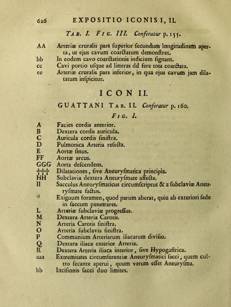 / Tab, /. F J G. III. Conferatur p. i$$. AA Arteriae cruralis pars fuperior fecundum longitudinem aper- ta , ut ejus cavum coartatum demonftret. bb In eodem cavo coartationis indicium fignant. cc Cavi portio ufque ad litteras dd fere tota coartata, ee Arteriae cruralis pars inferior, in qua ejus cavum jam dila- tatum infpicitur. ICONII. GU AT T ANI Tab. II. Conferatur p. 160. Fi g. 1. A Facies cordis anterior. B Dextera cordis auricula. C Auricula cordis finiftra. D Pulmonica Arteria refeta. E Aortae finus. FF Aortae arcus. GGG Aorta defcendens. •jJ**{* Dilatationes, live Aneuryfmatica principia. HH Subclavia dextera Aneuryfmate affeta. II Sacculus Aneuryfmaticus circumfcriptus & a fubclaviae Aneu- ryfmate fatus. Exiguum foramen, quod parum aberat, quin ab exteriori fede in faecum penetraret. L Arteriae fubclaviae progreffus. M Dextera Arteria Carotis. N Arteria Carotis finiftra. O Arteria fubclavia finiftra. P Communium Arteriarum iliacarum divifio. Q Dextera iliaca exterior Arteria. R Dextera Arteria iliaca interior, five Hypogaftrica. aaa Extremitates circumferentiae Aneuryfmatici facci, quem cul- tro fecante aperui, quum verum effet Aneuryfma. bb Incifionis facci duo limites.