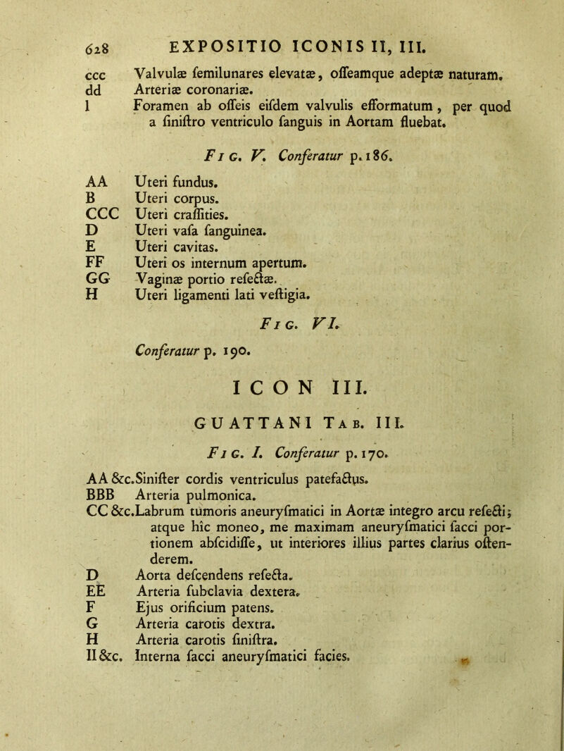 ccc Valvulae femilunares elevatae, offeamque adeptas naturam, dd Arteriae coronariae. I Foramen ab offeis eifdem valvulis efformatum , per quod a finiftro ventriculo fanguis in Aortam fluebat. F i G. V, Conferatur p. 186* A A Uteri fundus. B Uteri corpus. CCC Uteri craflities. D Uteri vafa fanguinea. E Uteri cavitas. FF Uteri os internum apertum. GG Vaginae portio refeftse. H Uteri ligamenti lati veftigia. Fig. VL Conferatur p. 190. ICON III. G U ATT ANI Tab. IIL Fi G, /. Conferatur p. 170. AA&c.Sinifter cordis ventriculus patefa&us. BBB Arteria pulmonica. CC&c.Labrum tumoris aneuryfmatici in Aortas integro arcu refe&i; atque hic moneo, me maximam aneuryfmatici faeci por- tionem abfcidifle, ut interiores illius partes darius often- derem. D Aorta defcendens refefta. EE Arteria fubclavia dextera. F Ejus orificium patens. G Arteria carotis dextra. H Arteria carotis finiftra. II &c. Interna facci aneuryfmatici facies.