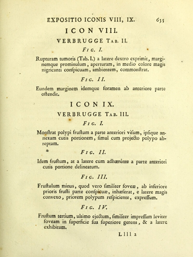 ICON VIII. VERBRUGGE Tab. II. Fi g. I. Rupturam tumoris (Tab. I.) a latere dextro exprimit, margi- nemque prominulum, aperturam, in medio colore magis nigricanti confpicuam, ambientem, commonftrat. Fig. //. Eundem marginem idemque foramen ab anteriore parte oftendit. ICON IX. VERBRUGGE Tab. III. Fi g. I. Monftrat polypi fruftum a parte anteriori vifum, ipfique an- nexam cutis portionem, ftmul cum proje&o polypo ab- reptam. * Fig. II. Idem fruftum, at a latere cum adhaerente a parte anteriori cutis portione delineatum. Fi g* III. Fruftulum minus, quod vero ftmiliter foveae, ab inferiore prioris frufti parte confpicuae, inhaeferat, e latere magis convexo, priorem polypum refpiciente, expreffum. Fig. IV. Fruftum tertium, ultimo ejeflum, ftmiliter impreffam leviter foveam in fuperficie fua fuperiore gerens, & a latere exhibitum. L 111 2