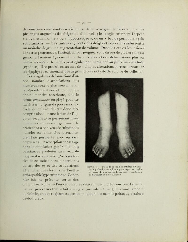 déformations consistant essentiellement dans une augmentation de volume des phalanges unguéales des doigts ou des orteils; les ongles prennent l’aspect « en verre de montre » ou « hippocratique », ou en « bec de perroquet » ; ils sont ramollis. — Les autres segments des doigts et des orteils subissent à un moindre degré une augmentation de volume. Dans les cas où les lésions sont très prononcées, l’articulation du poignet, celle du cou-de-pied et celle du genou présentent également une hypertrophie et des déformations plus ou moins accusées ; le rachis peut également participer au processus morbide (cyphose), lise produiten un mot de multiples altérations portant surtout sur les épiphyses et amenant une augmentation notable du volume de celles-ci. Ces singulières déformations d’un bon nombre d’articulations des membres sont le plus souvent sous la dépendance d’une affection bron- cho-pulmonaire antérieure, d’où le terme pneinniqiie employé pour ca- ractériser l’origine du processus. Le cycle de celui-ci devrait donc être compris ainsi : i une lésion de l’ap- pareil respiratoire permettant, sous l’influence de micro-organismes, la production à ce niveau de substances putrides ou fermentées (bronchite, pleurésie purulente avec ou sans empvème) ; 2” résorption et passage dans la circulation générale de ces substances produites au niveau de l’appareil respiratoire ; 3° action élec- tive de ces substances sur certaines parties des os et des articulations déterminant les lésions de l’ostéo- arthropathie hypertrophique. Ce der- nier fait ne présente certes rien d’invraisemblable, si l’on veut bien se souvenir de la précision avec laquelle, par un processus tout à fait analogue (microbes à part), la goutte, grâce à l’uricémie, frappe toujours ou presque toujours les mêmes points du système ostéo-lîbreux. Kiguke 6. — Pieds de la malade atteinte d’Ostéo- arthropathie hypertrophiante pneumique. — Ong-les en verre de montre, pieds engorg-és, gonflement de l'articulation tibio-tarsienne.