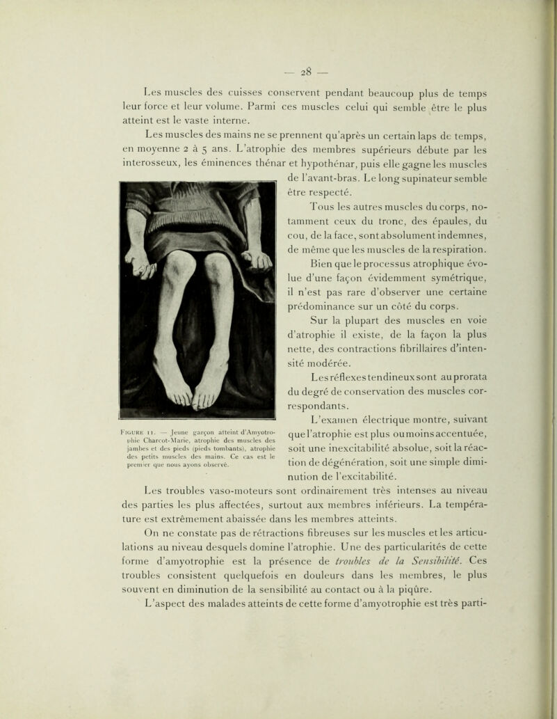 I,es muscles des cuisses conservent pendant beaucoup plus de temps leur force et leur volume. Parmi ces muscles celui qui semble être le plus atteint est le vaste interne. Les muscles des mains ne se prennent qu’après un certain laps de temps, en moyenne 2 à 5 ans. L’atrophie des membres supérieurs débute par les interosseux, les éminences thénar et hypothénar, puis elle gagne les muscles de r avant-bras. Le long supinateur semble être respecté. Tous les autres muscles du corps, no- tamment ceux du tronc, des épaules, du cou, de la face, sontabsolument indemnes, de même que les muscles de la respiration. Bien que le processus atrophique évo- lue d’une façon évidemment symétrique, il n’est pas rare d’observer une certaine prédominance sur un côté du corps. Sur la plupart des muscles en voie d’atrophie il existe, de la façon la plus nette, des contractions fibrillaires d’inten- sité modérée. Les réflexes tendineux sont au prorata du degré de conservation des muscles cor- respondants. L’examen électrique montre, suivant Figure ii. - Jeune gfarçon atteint d’Amyotro- quel’atrophie eSt pluS OUIlloinS aCCentuée, phie Charcot-Marie, atrophie des muscles des ^ f . jambes et des pieds (pieds tomliants), atrophie SOlt Une ineXCltablllté absolue, SOlt la réaC- des petits muscles des mains. Ce cas est le . , , , , , • ■ • i j' ' premier tpie nous ayons observé. tiou de degeneration, SOlt Une Simple dimi- nution de l’excitabilité. Les troubles vaso-moteurs sont ordinairement très intenses au niveau des parties les plus affectées, surtout aux membres inférieurs. La tempéra- ture est extrêmement abaissée dans les membres atteints. On ne constate pas de rétractions fibreuses sur les muscles et les articu- lations au niveau desquels domine l’atrophie. Une des particularités de cette forme d’amyotrophie est la présence de troubles de la Seusibiltté. Ces troubles consistent quelquefois en douleurs dans les membres, le plus souvent en diminution de la sensibilité au contact ou à la piqûre. L’aspect des malades atteints de cette forme d’amyotrophie est très parti-