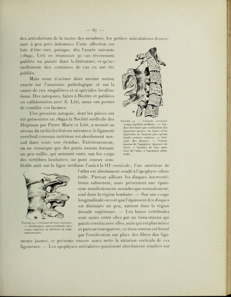 des articulations de la racine des membres, les petites articulations demeu- rant à peu près indemnes. Cette affection est loin d’être rare, puisque, dès l’année suivante (1899), Léri en réunissait 30 cas récemment iés ou puisés dans la littérature, et qu’ac- tuellement des centaines de cas en ont été lés. Mais nous n’avions alors aucune notion exacte sur l’anatomie pathologique et sur la cause de ces singulières et si spéciales localisa- tions. Des autopsies, faites à Bicêtre et publiées en collaboration avec A. Léri, nous ont permis de combler ces lacunes. Une première autopsie, dont les pièces ont été présentées en 1899 a la Société médicale des Hôpitaux par Pierre Marie et Léri, a montré au niveau du rachis les lésions suivantes : le ligament vertébral commun antérieur est absolument nor- mal dans toute son étendue. Extérieurement, on ne remarque que des ponts osseux formant un peu saillie, qui unissent entre eux les corps des vertèbres lombaires; un pont osseux sem- blable unit sur la ligne médiane l’axis à la 111'' cervicale; l’arc antérieur de l’atlas est absolument soudé à l’apophyse odon- toïde. Partout ailleurs les disques interverté- braux subsistent, mais présentent une épais- seur manifestement moindre que normalement, sauf dans la région lombaire. — Sur une coupe longitudinale on voit que l’épaisseur des disques est diminuée un peu, surtout dans la région dorsale supérieure. — Les lames vertébrales sont unies entre elles par un tissu osseux qui paraît continu avec elles, mais qui est plus mince et partout transparent ; ce tissu osseux est formé par l’ossification sur place des fibres des liga- ments jaunes, et présente encore assez nette la striation verticale de ces ligaments. — Les apophyses articulaires paraissent absolument soudées sur Figure34.—Colonne dorsale moyenne. — Ossification costo-vertébrale (fais- ceaux supérieur et inférieur) et costo- transversaire. Figure 33. — Colonne cervicale (coupe sagfittale médiane). — Sou- dure des lames par ossification des ligaments jaunes; les lames et les ligaments ne forment plus qu’une bande osseuse continue. — Inté- grité des disques. — Volume énorme de l’apophyse épineuse de l’axis. — Soudure de l’arc anté- rieur de l’atlas à l’apophyse odon- toïde.