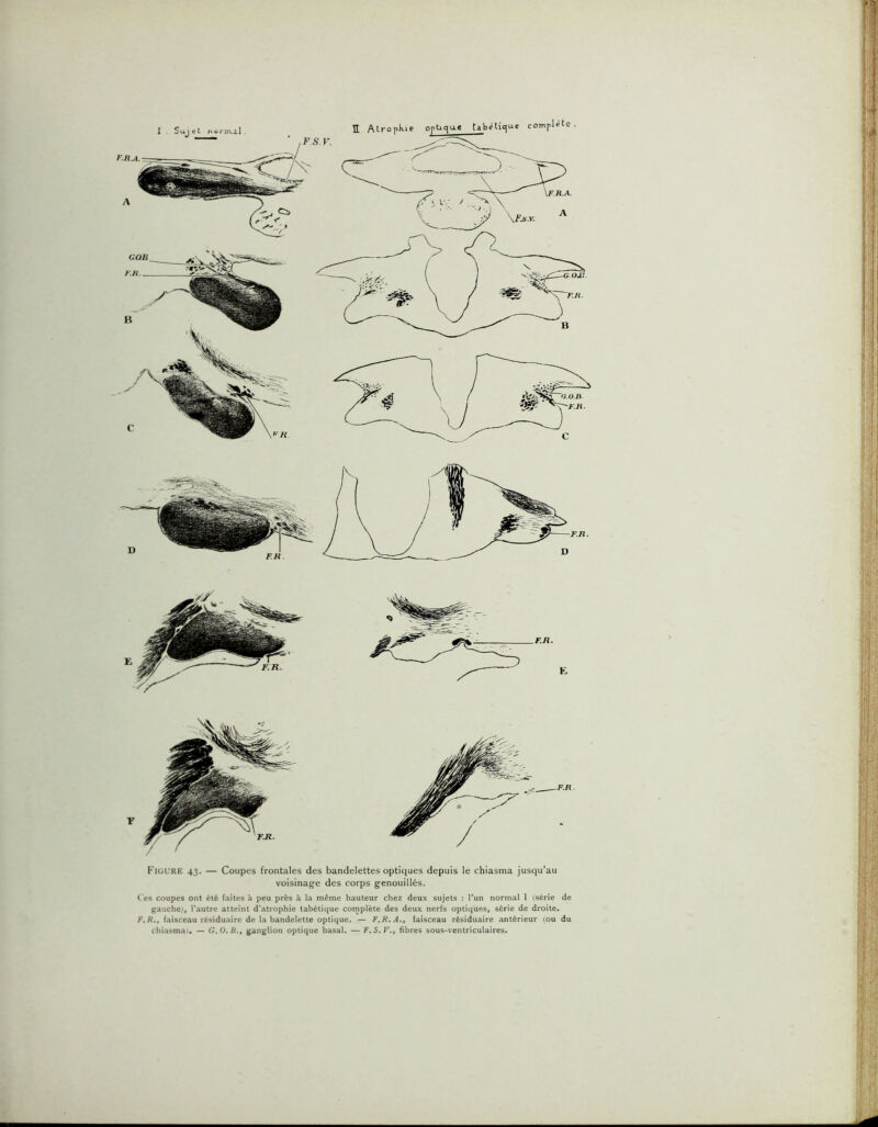 F. s. y. Figure 43. — Coupes frontales des bandelettes optiques depuis le chiasma jusqu^au voisinage des corps genouillés. ( es coupes ont été faites à peu près à la même hauteur chez deux sujets : l’un normal 1 (série de gauche;, l’autre atteint d’atiophie tabétique cornplète des deux nerfs optiques, série de droite, F.R.t faisceau résiduaire de la bandelette optique. — F.R.A.» faisceau résiduaire antérieur (ou du chiasmau — G.O. if., ganglion optique basal. — F. 5. T., fibres sous-ventriculaires.