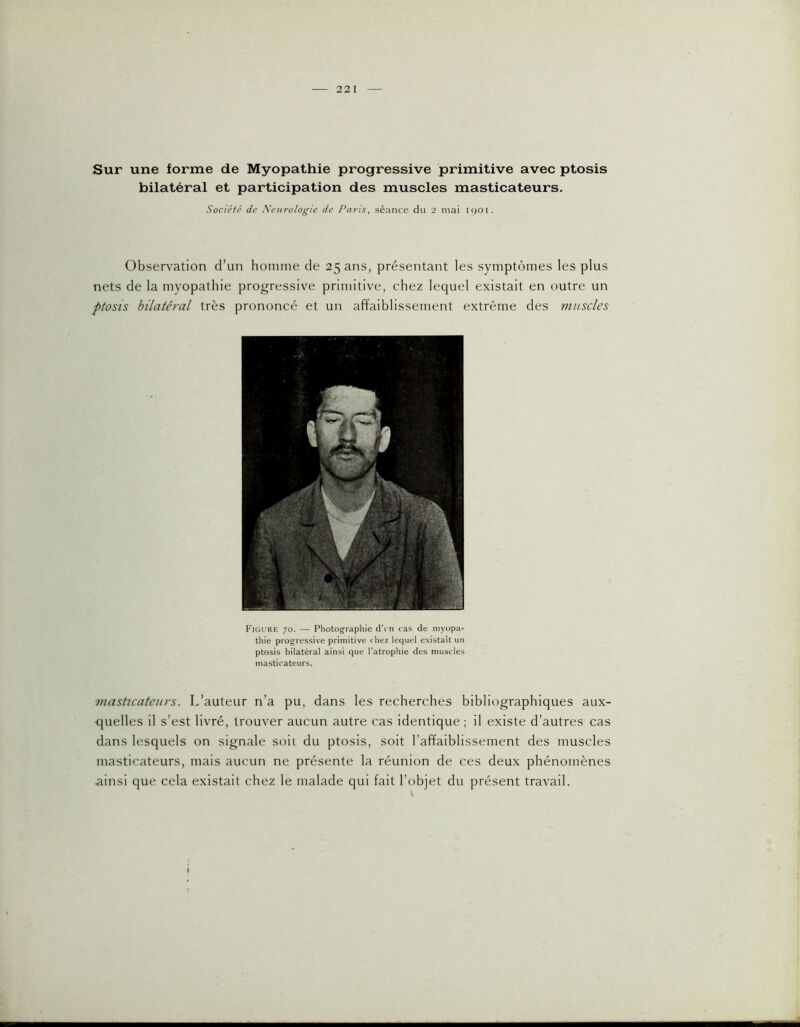 22 I Sur une forme de Myopathie progressive primitive avec ptosis bilatéral et participation des muscles masticateurs. Société de Neurologie de Paris, séance du 2 mai igoi. Observation d’un homme de 25 ans, présentant les symptômes les plus nets de la myopathie progressive primitive, chez lequel existait en outre un ptosis bilatéral très prononcé et un affaiblissement extrême des muscles Figure 70. — Photographie d’i n cas de myopa- thie progressive primitive chez lequel existait un ptosis bilatéral ainsi que l’atrophie des muscles masticateurs. masticateurs. L’auteur n’a pu, dans les recherches bibliographiques aux- quelles il s’est livré, trouver aucun autre cas identique ; il existe d’autres cas dans lesquels on signale soir du ptosis, soit l’affaiblissement des muscles masticateurs, mais aucun ne présente la réunion de ces deux phénomènes ainsi que cela existait chez le malade qui fait l’objet du présent travail. \ I