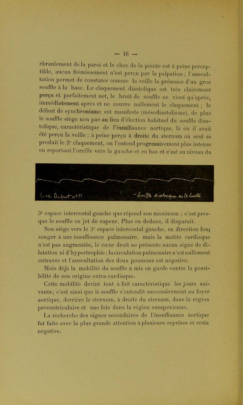ébranlement delà paroi et le choc de la pointe est à peine percep- tible, aucun frémissement n’est perçu par la palpation ; l’auscul- tation permet de constater comme la veille la présence d’un gros souffle à la base. Le claquement diastolique est très clairement perçu et parfaitement net, le bruit de souffle ne vient qu’après, immédiatement après et ne couvre nullement le claquement ; le défaut de synchronisme est manifeste (mésodiastolisme), de plus le souffle siège non pas au lieu d’élection habituel du souffle dias- tolique, caractéristique de l’insuffisance aortique, là où il avait été perçu la veille : à peine perçu à droite du sternum où seul se produit le 2e claquement, on l’entend progressivement plus intense en reportant 1 oreille vers la gauche et en bas et c’est au niveau du Struffât, eitb 3° espace intercostal gauche que répond son maximum ; c’est pres- que le souffle en jet de vapeur. Plus en dedans, il disparaît. Son siège vers le 3e espace intercostal gauche, sa direction font songer à une insuffisance pulmonaire, mais la matité cardiaque n’est pas augmentée, le cœur droit ne présente aucun signe de di- latation ni d’hypertrophie ; la circulation pulmonaire n’est nullement entravée et l’auscultation des deux poumons est négative. Mais déjà la mobilité du souffle a mis en garde contre la possi- bilité de son origine extra-cardiaque. Cette mobilité devint tout à fait caractéristique les jours sui- vants; c’est ainsi que le souffle s’entendit successivement au foyer aortique, derrière le sternum, à droite du sternum, dans la région préventriculaire et une fois dans la région susapexienne. La recherche des signes secondaires de l’insuffisance aortique fut faite avec la plus grande attention à plusieurs reprises et resta négative.