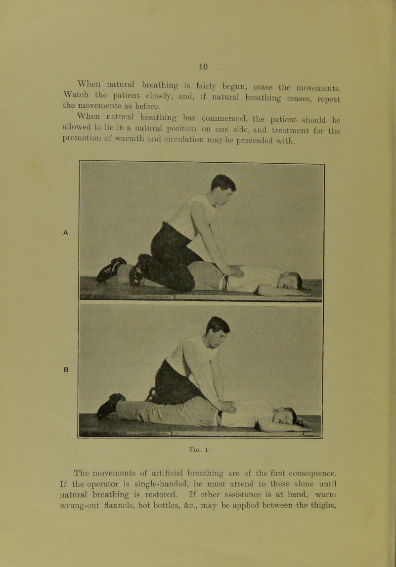 When natural breathing is fairly begun, cease the movements. Watch the patient closely, and, if natural breathing ceases, repeat the movements as before. When natural breathing has commenced, the patient should be allowed to he in a natural position on one side, and treatment for the promotion of warmth and circulation may be proceeded with. Fig. 1. The movements of artificial breathing are of the first consequence. If the operator is single-handed, he must attend to these alone until natural breathing is restored. If other assistance is at hand, warm wrung-out flannels, hot bottles, &c., may be applied between the thighs,