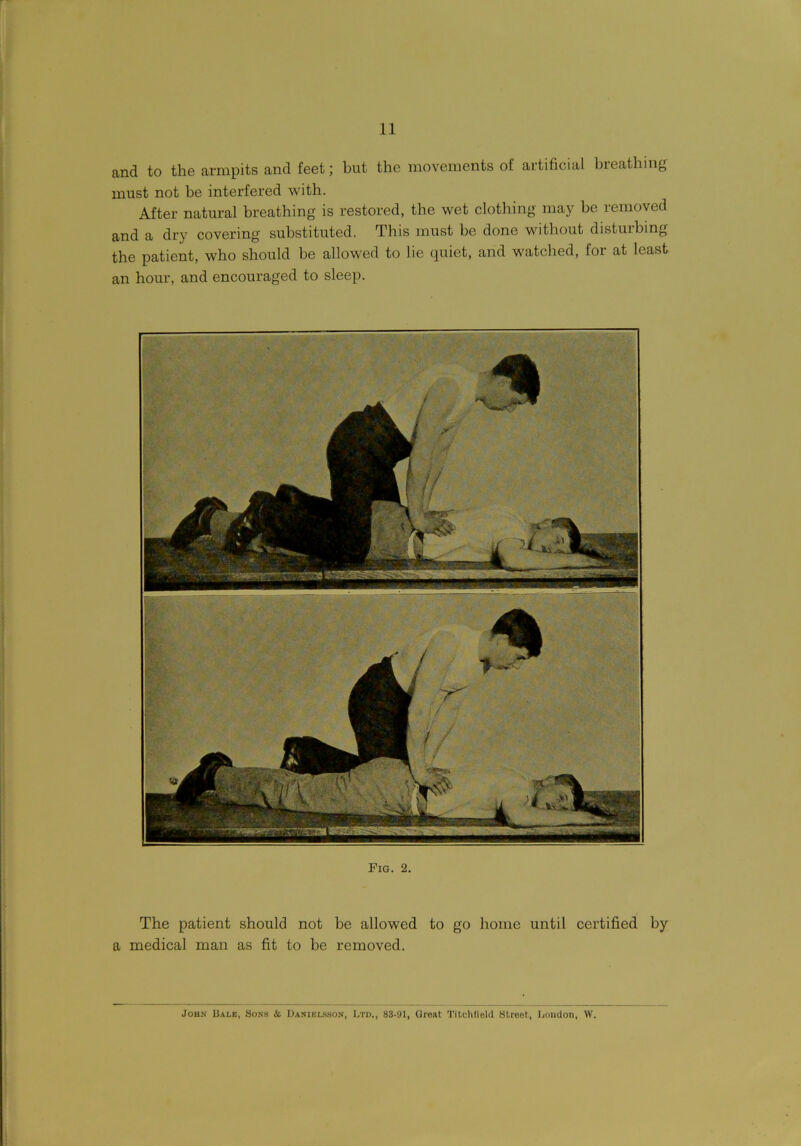 and to the armpits and feet; but the movements of artificial breathing must not be interfered with. After natural breathing is restored, the wet clothing may be removed and a dry covering substituted. This must be done without disturbing the patient, who should be allowed to lie quiet, and watched, for at least an hour, and encouraged to sleep. Fig. 2. The patient should not be allowed to go home until certified by a medical man as fit to be removed. John Bale, Sons & Danielsson, Ltd., 83-91, Groat Titclilield Street, Loudon, W.