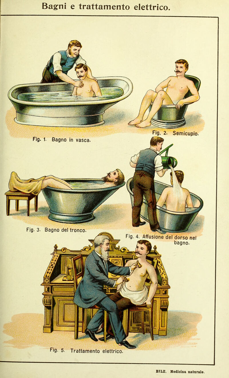 Bagni e trattamento elettrico nel bagno. Fig. 1. Bagno in vasca. 2. Semicupio. Fig. 3. Bagno del tronco. Fig. 5. Trattamento elettrico.