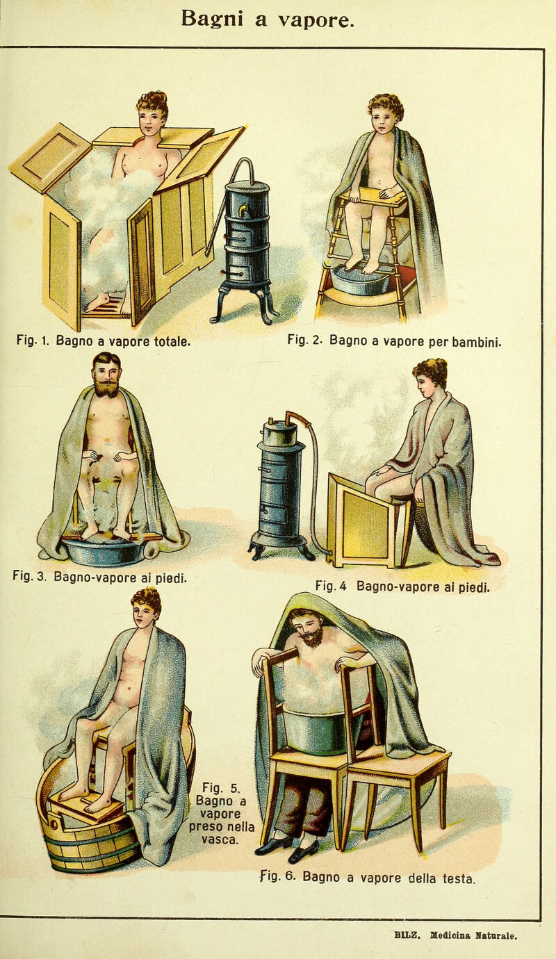 Bagni a vapore Fig. 2. Bagno a vapore per bambini. Fig. 3. Bagno-vapore ai piedi. Fig. 4 Bagno-vapore ai piedi. Fig. 5. Bagno a vapore preso nella vasca. Fig. 6. Bagno a vapore della testa.