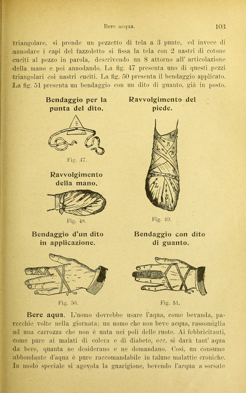 triangolare, si prende un pezzetto di tela a 3 punte, ed invece di annodare i capi del fazzoletto si fissa la tela con 2 nastri di cotone cuciti al pezzo in parola, descrivendo un 8 attorno all' articolazione «Iella mano e poi annodando. La fig. 47 presenta uno di questi pezzi triangolari coi nastri cuciti. La fig. 50 presenta il bendaggio applicato. La fig. 51 presenta un bendaggio con un dito di guanto, già in posto. Bendaggio per la punta del dito. Ravvolgimento della mano. Fig. 48. Ravvolgimento del piede. Fig. 49. Bendaggio d’un dito in applicazione. Fig. 50. O Bendaggio con dito di guanto. Fig. 51. Bere aqua. L’uomo dovrebbe usare l’aqua, come bevanda, pa- recchie volte nella giornata; un uomo che non beve acqua, rassomiglia ad una carrozza che non è unta nei poli delle ruote. Ai febbricitanti, •come pure ai malati di colera e di diabete, ecc. si darà tant’ aqua da bere, quanta ne desiderano e ne domandano. Così, un consumo abbondante d’aqua è pure raccomandabile in talune malattie croniche. In modo speciale si agevola la guarigione, bevendo l’acqua a sorsate
