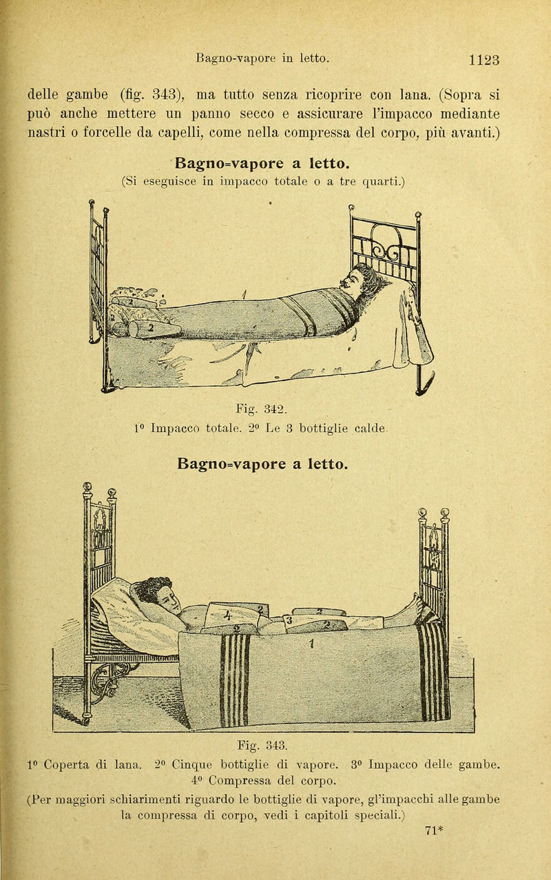 delle gambe (fig. 343), ma tutto senza ricoprire con lana. (Sopra si può anche mettere un panno secco e assicurare l’impacco mediante nastri o forcelle da capelli, come nella compressa del corpo, più avanti.) 1° Coperta di lana. 2° Cinque bottiglie di vapore. 3° Impacco delle gambe. 4° Compressa del corpo. (Per maggiori schiarimenti riguardo le bottiglie di vapore, gl’impacchi alle gambe la compressa di corpo, vedi i capitoli speciali.) Bagno=vapore a letto. (Si eseguisce in impacco totale o a tre quarti.) Fig. 342. 1° Impacco totale. 2° Le 3 bottiglie calde. Bagno=vapore a letto. 71*