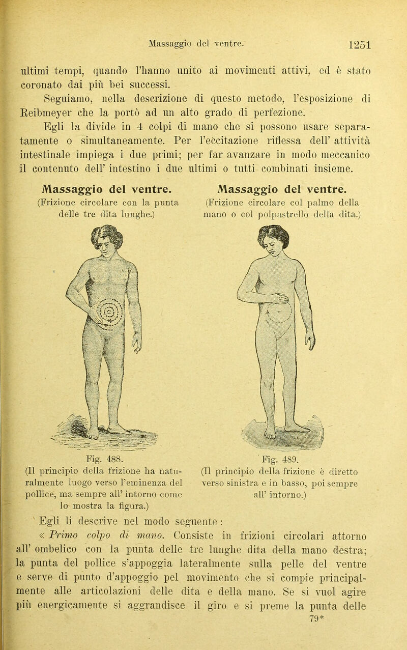 ultimi tempi, quando l’iianno unito ai movimenti attivi, ed è stato coronato dai più bei successi. Seguiamo, nella descrizione di questo metodo, l’esposizione di Reibmeyer che la portò ad un alto grado di perfezione. Egli la divide in 4 colpi di mano che si possono usare separa- tamente o simultaneamente. Per l’eccitazione riflessa dell’ attività intestinale impiega i due primi; per far avanzare in modo meccanico il contenuto dell’ intestino i due ultimi o tutti combinati insieme. Massaggio del ventre. (Frizione circolare con la punta delle tre dita lunghe.) Talmente luogo verso l’eminenza del pollice, ma sempre all’ intorno come lo mostra la figura.) Massaggio del ventre. (Frizione circolare col palmo della mano o col polpastrello della dita.) (Il principio della frizione è diretto verso sinistra e in basso, poi sempre all’ intorno.) Egli li descrive nel modo seguente : « Primo colpo di mano. Consiste in frizioni circolari attorno all’ ombelico con la punta delle tre lunghe dita della mano destra; la punta del pollice s’appoggia lateralmente sulla pelle del ventre e serve di punto d’appoggio pel movimento che si compie principal- mente alle articolazioni delle dita e della mano. Se si vuol agire più energicamente si aggrandisce il giro e si preme la punta delle 79*