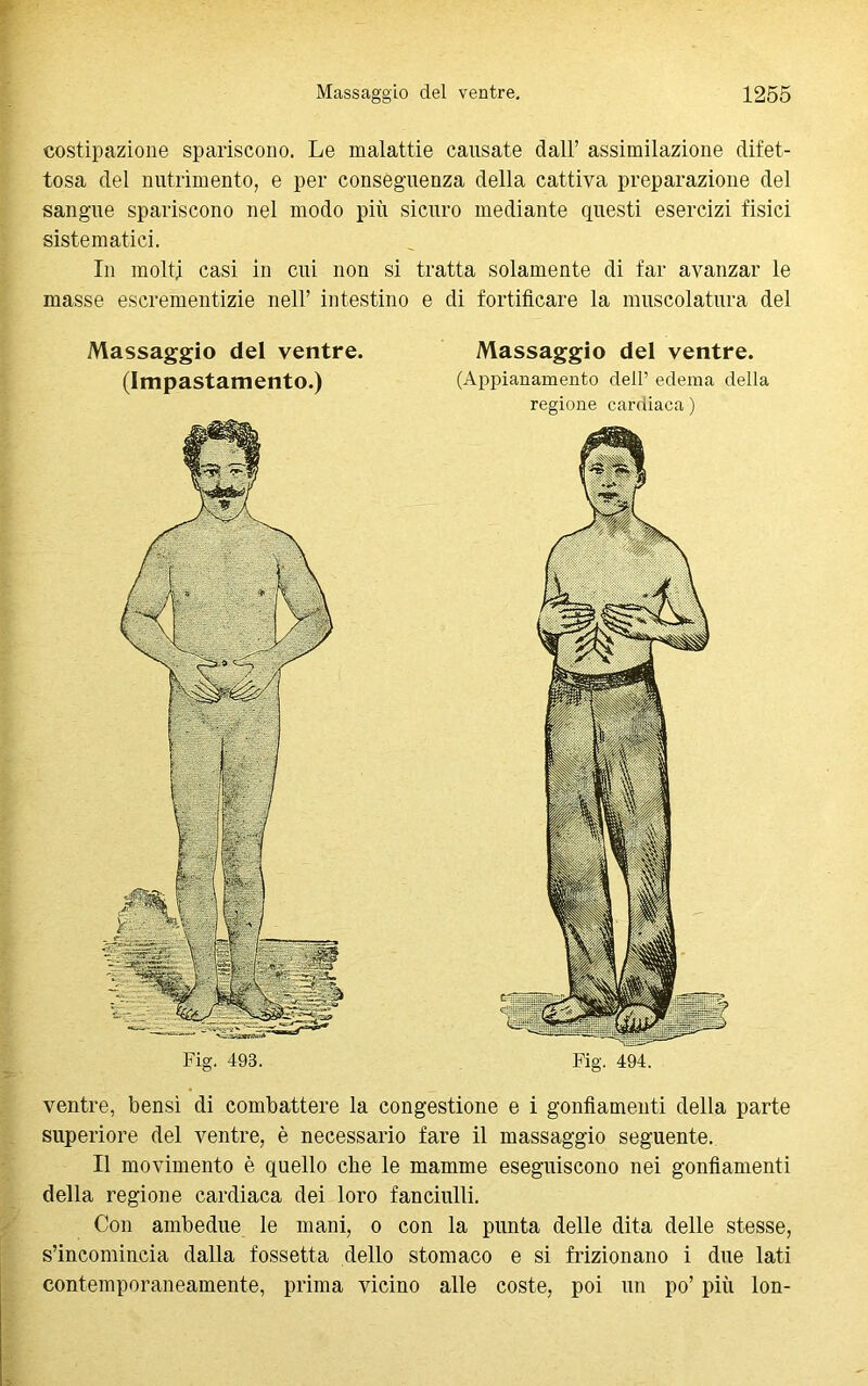 costipazione spariscono. Le malattie causate dall’ assimilazione difet- tosa del nutrimento, e per conseguenza della cattiva preparazione del sangue spariscono nel modo più sicuro mediante questi esercizi fisici sistematici. In molti casi in cui non si tratta solamente di far avanzar le masse escrementizie nel! intestino e di fortificare la muscolatura del Massaggio del ventre. (Impastamento.) Fig. 498. Massaggio del ventre. (Appianamento dell’ edema della regione cardiaca) Fig. 494. ventre, bensì di combattere la congestione e i gonfiamenti della parte superiore del ventre, è necessario fare il massaggio seguente. Il movimento è quello che le mamme eseguiscono nei gonfiamenti della regione cardiaca dei loro fanciulli. Con ambedue le mani, o con la punta delle dita delle stesse, s’incomincia dalla fossetta dello stomaco e si frizionano i due lati contemporaneamente, prima vicino alle coste, poi un po’ più lon-