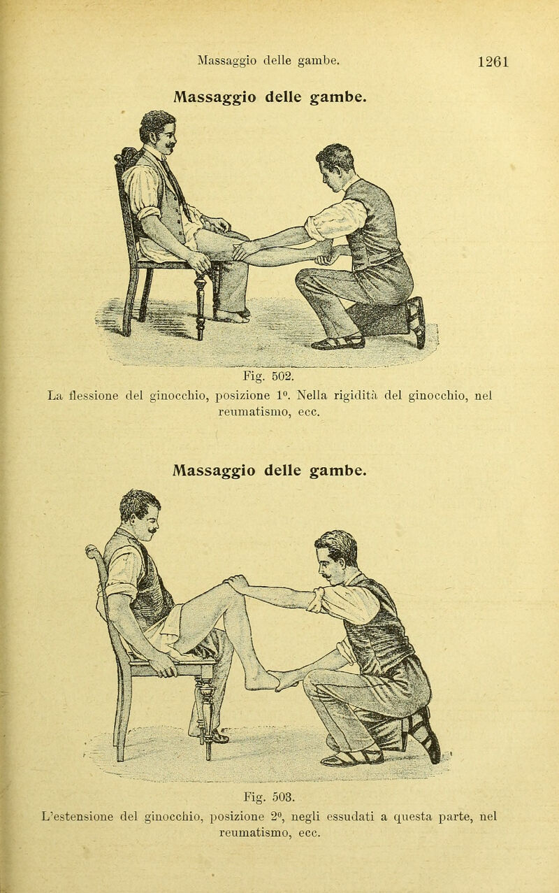 Massaggio delle gambe. Fig. 502. La flessione del ginocchio, posizione 1°. Nella rigidità del ginocchio, nel reumatismo, ecc. Massaggio delle gambe. Fig. 503. L’estensione del ginocchio, posizione 2°, negli essudati a questa parte, nel reumatismo, ecc.