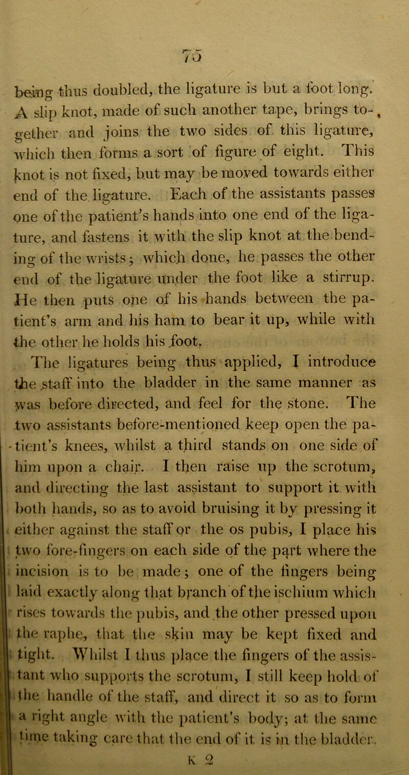 bei^ig thus doubled, the ligature is but a foot long. A slip knot, made of such another tape, brings to-. gether and joins the two sides of. this ligature, which then forms a sort of figure of eight. This jviiot is not fixed, but may be moved towards either end of the ligature. Each of the assistants passes one of the patient’s hands into one end of the liga- ture, and fastens it with the slip knot at the bend- ing of the wrists, which done, he passes the other end of the ligature under the foot like a stirrup. He then puts one of his diands between the pa- tient’s aim and his ham to bear it up, while with the other he holds his .foot, The ligatures being thus applied, I introduce the .staff into the bladder in the same manner as was before directed, and feel for the stone. The two assistants before-mentioned keep open the pa- -tient’s knees, whilst a third stands on one side of him upon a chair. I then raise up the scrotum, and directing the last assistant to support it with both hands, so as to avoid bruising it by pressing it either against the staff or the os pubis, I place his two fore-fingers on each side of the pa^’t where the incision is to be made; one of the fingers being ' laid exactly along that branch of the ischium which rises towards the ])ubis, and the other pressed upon : the raphe, that the skin may be kept fixed and I tight. Whilst I thus place the fingers of the assis- tant who supports the scrotum, I still keep hold of ' the handle of the staff, and direct it so as to form a right angle with the patient’s body; at the same time taking care that the end of it is in the bladder.
