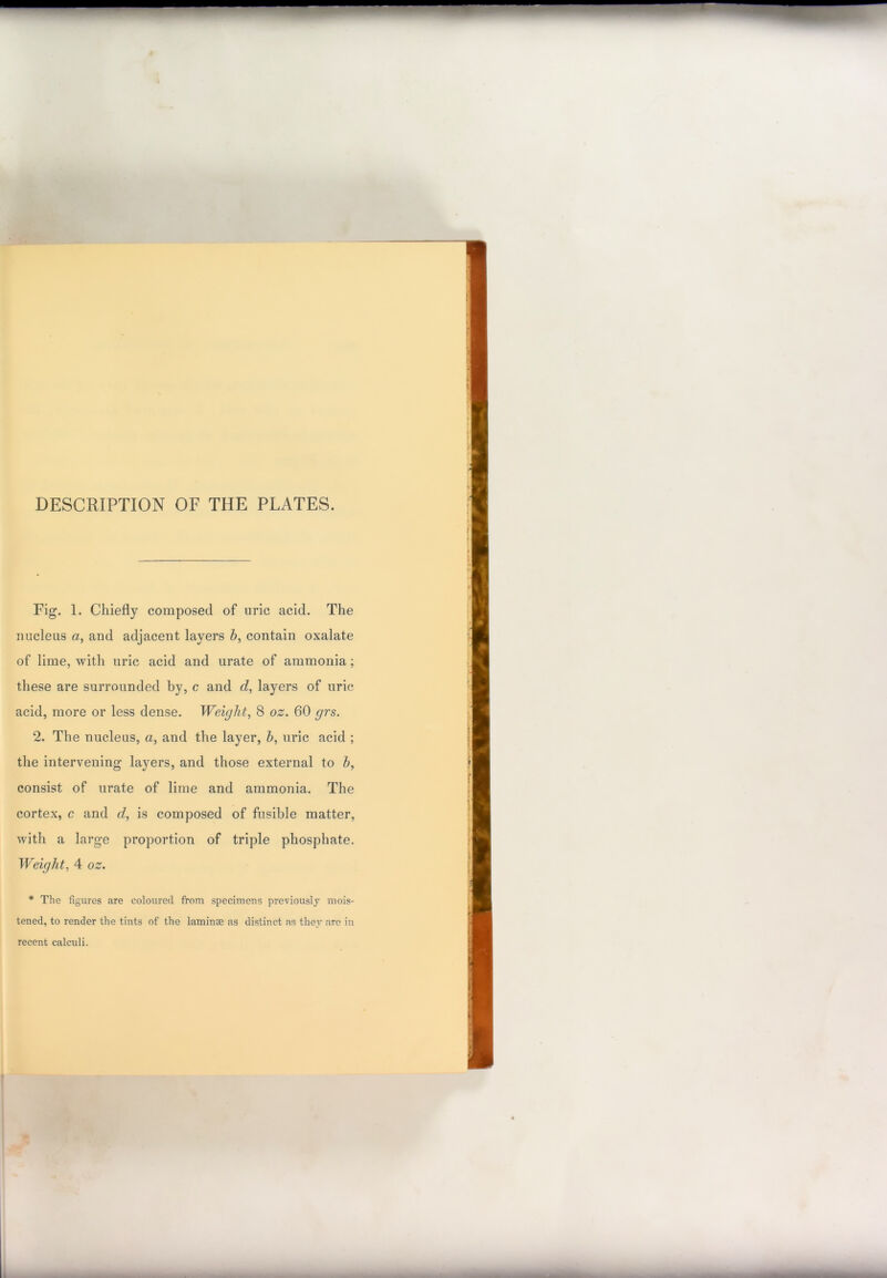 DESCRIPTION OF THE PLATES. Fig. 1. Chiefly composed of uric acid. The nucleus «, and adjacent layers h, contain oxalate of lime, with uric acid and urate of ammonia; these are surrounded by, c and d, layers of uric acid, more or less dense. Weight, 8 oz. 60 grs. 2. The nucleus, a, and the layer, h, uric acid ; the intervening layers, and those external to b, consist of urate of lime and ammonia. The cortex, c and d, is composed of fusible matter, with a large proportion of triple phosphate. Weight, 4 oz. * The figures are coloured from specimens previously mois- tened, to render the tints of the laminae as distinct as they are in recent calculi.