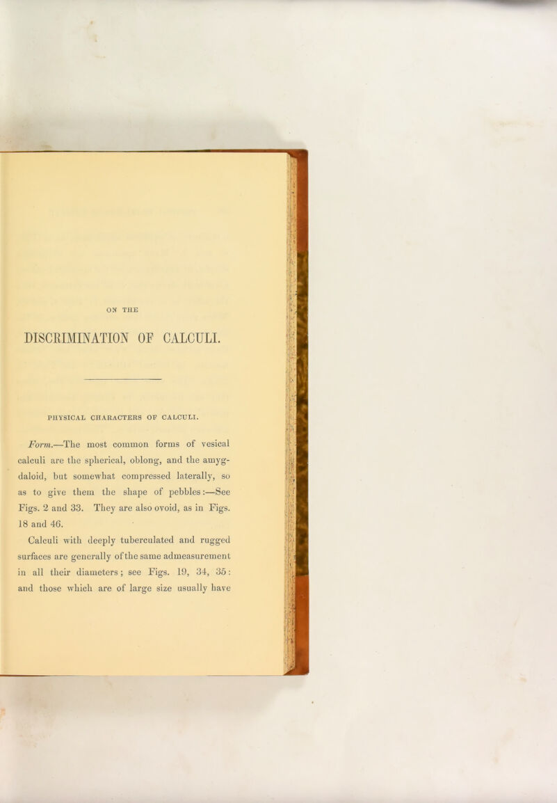 DISCRIMINATION OR CALCULI. PHYSICAL CHARACTERS OF CALCULI. Form.—The most common forms of vesical calculi are the spherical, oblong, and the amyg- daloid, but somewhat compressed laterally, so as to give them the shape of pebbles:—See Figs. 2 and 33. They are also ovoid, as in Figs. 18 and 46. Calculi with deeply tuberculated and rugged surfaces are generally of the same admeasurement in all their diameters; see Figs. 19, 34, 35: and those which are of large size usually have