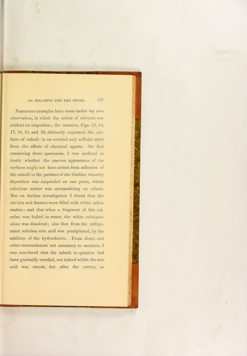 Numerous examples have come under my own observation, in which the action of solvents was evident on inspection ; for instance, Figs, 13, 14, 17, 18, 19, and 28, distinctly represent the sur- faces of calculi in an erroded and cellular state from the effects of chemical agents. On first examining these specimens, I was inclined to doubt whether the uneven appearance of the surfaces mio-ht not have arisen from adhesion of the calculi to the parietes of the bladder, whereby deposition was suspended on one point, whilst calculous matter was accumulating on others. But on further investigation I found that the cavities and fissures were filled with white saline matter; and that when a fragment of this cal- culus was boiled in water, the white substance alone was dissolved; also that from the refrige- rated solution uric acid was precipitated, by the addition of the hydrochloric. From these, and other circumstances not necessary to mention, I was convinced that the calculi in question had been gradually erroded, not indeed whilst the uric acid was recent, but after the cortex, as