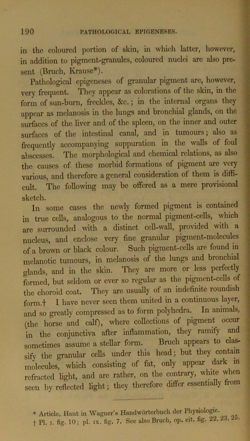 in the coloured portion of skin, in which latter, however, in addition to pigment-granules, coloured nuclei are also pre- sent (Bruch, Krause*). Pathological epigeneses of granular pigment are, however, very frequent. They appear as colorations of the skin, in the form of sun-burn, freckles, &c.; in the internal organs they appear as melanosis in the lungs and bronchial glands, on the surfaces of the liver and of the spleen, on the inner and outer surfaces of the intestinal canal, and in tumours, also as frequently accompanying suppuration in the walls of foul abscesses. The morphological and chemical relations, as also the causes of these morbid formations of pigment are very various, and therefore a general consideration of them is diffi- cult. The following may be offered as a mere provisional sketch. In some cases the newly formed pigment is contained in true cells, analogous to the normal pigment-cells, which are surrounded with a distinct cell-wall, provided with a nucleus, and enclose very fine granular pigment-molecules of a brown or black colour. Such pigment-cells are found m melanotic tumours, in melanosis of the lungs and bronchial glands, and in the skin. They are more or less perfectly formed, but seldom or ever so regular as the pigment-cells of the choroid coat. They are usually of an indefinite roundish form.f I have never seen them united in a continuous layer, and so greatly compressed as to form polyhedra. In animals, (the horse and calf), where collections of pigment occur in the conjunctiva after inflammation, they ramify and sometimes assume a stellar form. Bruch appears to clas- sify the granular cells under this head; but they contain molecules, which consisting of fat, only appear dark m refracted light, and are rather, on the contrary, white when seen by reflected light; they therefore differ essentially from * Article, Haut in Wagner’s Handworterbuch der Physiologie. f PI. i. fig. 10; pi. xx. fig. 7. See also Bruch, op. cit. fig. 22, 23, -u