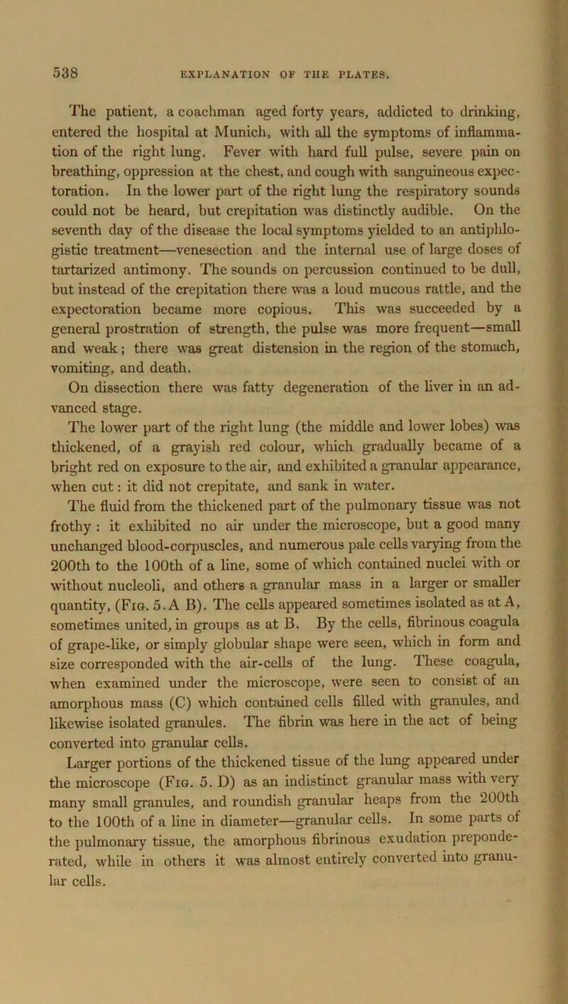 The patient, a coachman aged forty years, addicted to drinking, entered the hospital at Munich, with all the symptoms of inflamma- tion of the right lung. Fever with hard full pulse, severe pain on breathing, oppression at the chest, and cough with sanguineous expec- toration. In the lower part of the right lung the respiratory sounds could not be heard, but crepitation was distinctly audible. On the seventh day of the disease the local symptoms yielded to an antiphlo- gistic treatment—venesection and the internal use of large doses of tartarized antimony. The sounds on percussion continued to be dull, but instead of the crepitation there was a loud mucous rattle, and the expectoration became more copious. This was succeeded by a general prostration of strength, the pulse was more frequent—small and weak; there was great distension in the region of the stomach, vomiting, and death. On dissection there was fatty degeneration of the liver in an ad- vanced stage. The lower part of the right lung (the middle and lower lobes) was thickened, of a grayish red colour, which gradually became of a bright red on exposure to the air, and exhibited a granular appearance, when cut: it did not crepitate, and sank in water. The fluid from the thickened part of the pulmonary tissue was not frothy : it exhibited no air under the microscope, but a good many unchanged blood-corpuscles, and numerous pale cells varying from the 200th to the 100th of a line, some of which contained nuclei with or without nucleoli, and others a granular mass in a larger or smaller quantity, (Fig. 5. A B). The cells appeared sometimes isolated as at A, sometimes united, in groups as at B. By the cells, fibrinous coagula of grape-like, or simply globular shape were seen, which in form and size corresponded with the air-cells of the lung. These coagula, when examined under the microscope, were seen to consist of an amorphous mass (C) which contained cells filled with granules, and likewise isolated granules. The fibrin was here in the act of being converted into granular cells. Larger portions of the thickened tissue of the lung appeared under the microscope (Fig. 5. D) as an indistinct granular mass with very many small granules, and roundish granular heaps from the 200th to the 100th of a line in diameter—granular cells. In some parts of the pulmonary tissue, the amorphous fibrinous exudation preponde- rated, while in others it w'as almost entirely converted into granu- lar cells.