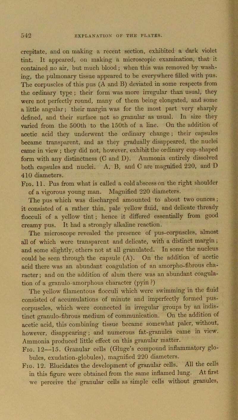 crepitate, and on making a recent section, exhibited a dark violet tint. It appeared, on making a microscopic examination, that it contained no air, but much blood; when this was removed by wash- ing, the pulmonary tissue appeared to be everywhere filled with pus. The corpuscles of this pus (A and B) deviated in some respects from the ordinary type ; their form was more irregular than usu<U, they were not perfectly round, many of them being elongated, and some a little angular; their margin was for the most part very sharply defined, and their surface not so granular as usual. In size they varied from the 500th to the 150th of a line. On the addition of acetic acid they underwent the ordinary change; their capsules became transparent, and as they gradually disappeared, the nuclei came in view ; they did not, however, exhibit the ordinary cup-shaped form with any distinctness (C and D). Ammonia entirely dissolved both capsules and nuclei. A, B, and C are magnified 220, and D 410 diameters. Fig. 11. Pus from what is called a cold abscess on the right shoulder of a vigorous young man. Magnified 220 diameters. The pus which was discharged amounted to about two ounces; it consisted of a rather thin, pale yellow fluid, and delicate thready flocculi of a yellow tint; hence it differed essentially from good creamy pus. It had a strongly alkaline reaction. The microscope revealed the presence of pus-corpuscles, almost nil of which were transparent and delicate, with a distinct margin; and some slightly, others not at all granulated. In some the nucleus could be seen through the capsule (A). On the addition of acetic acid there was an abundant coagulation of an amorpho-fibrous cha- racter ; and on the addition of alum there was an abundant coagula- tion of a granulo-amorphous character (pyin r) The yellow filamentous flocculi which were swimming in the fluid consisted of accumulations of minute and imperfectly formed pus- corpuscles, which were connected in irregular groups by an indis- tinct granulo-fibrous medium of communication. On the addition of acetic acid, this combining tissue became somewhat paler, without, however, disappearing; and numerous fat-granules came in view. Ammonia produced little effect on this granular matter. Fig. 12—15. Granular cells (Gluge’s compound inflammatory glo- bules, exudation-globules), magnified 220 diameters. Fig. 12. Elucidates the development of granular cells. All the cells in this figure were obtained from the same inflamed lung. At first we perceive the granular cells as simple cells without granules,