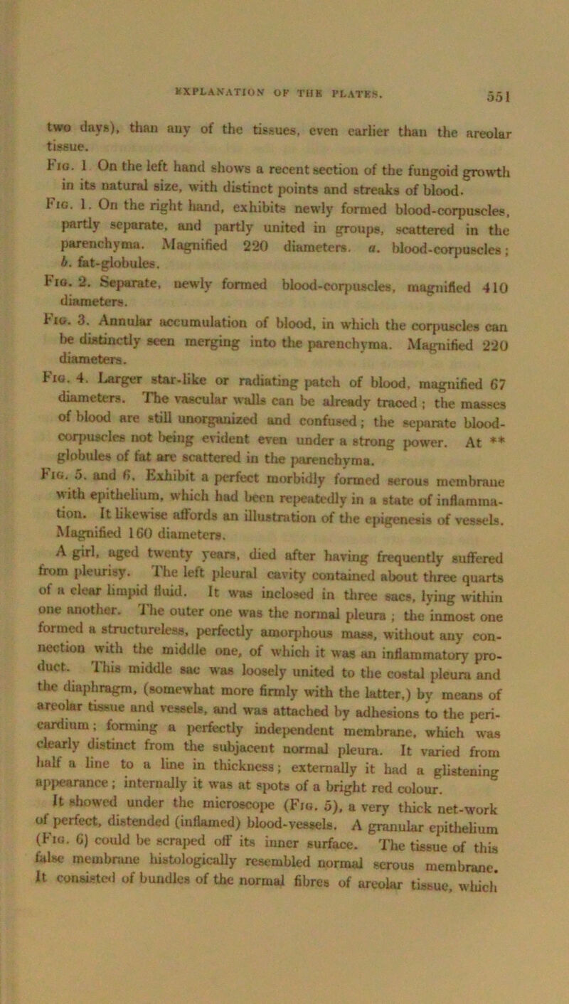 two days), than any of the tissues, even earlier than the areolar tissue. h ro. 1 On the left hand shows a recent section of the fungoid growth in its natural size, with distinct points and streaks of blood. 1 ig. 1. On the right hand, exhibits newly formed blood-corpuscles, partly separate, and partly united in groups, scattered in the parenchyma. Magnified 220 diameters, a. blood-corpuscles; b. fat-globules. Fm. 2. Separate, newly formed blood-corpuscles, magnified 410 diameters. Fig. 3. Annular accumulation of blood, in which the corpuscles can be distinctly seen merging into the parenchyma. Magnified 220 diameters. Fig. 4. Larger star-like or radiating patch of blood, magnified 67 diameters. The vascular walls can be already traced ; the masses of blood are still unorganized and confused; the separate blood- coqiuscles not being evident even under a strong power. At ** globules of tat are scattered in the parenchyma. Fig. 5. and 6. Exhibit a perfect morbidly formed serous membrane with epithelium, which had been repeatedly in a state of inflamma- tion. It likewise affords an illustration of the epigenesis of vessels. Magnified 160 diameters. A girl, aged twenty years, died after having frequently suffered from pleurisy. The left pleural cavity contained about three quarts of a clear limpid fluid. It was inclosed in three sacs, lying within one another. 1 he outer one was the normal pleura ; the inmost one formed a structureless, perfectly amorphous mass, without any con- nection with the middle one, of which it was an inflammatory pro- duct. 1 his middle sac was loosely united to the costal pleura and the diaphragm, (somewhat more firmly with the latter,) by means of areolar tissue and vessels, and was attached by adhesions to the peri- cardium ; forming a perfectly independent membrane, which was clearly distinct from the subjacent normal pleura. It varied from half a line to a line in thickness; externally it had a glistening apj>earance; internally it was at spots of a bright red colour. It showed under the microsco^ (Fig. 5). a very thick net-work of perfect, distended (inflamed) blood-vessels. A granular epithelium (Fio. 6) could be scraped off its inner surface. The tissue of this false membrane histologically resembled normal serous membrane. It consisted of bundles of the normal fibres of areolar tissue, which