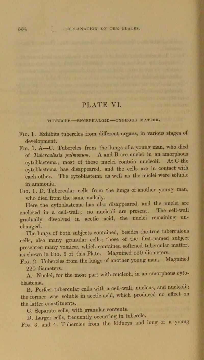 PLATE VI. TUBERCLE ENCEFHALOID TYPHOUS MATTER. Fig. 1. Exhibits tubercles from different organs, in various stages of development. Fig. 1. A—C. Tubercles from the lungs of a young man, who died of Tuberculosis pulmonum. A and B are nuclei in an amorphous cytoblastema; most of these nuclei contain nucleoli. At C the cytoblastema has disappeared, and the cells are in contact with each other. The cytoblastema as well as the nuclei were soluble in ammonia. Fig. 1. D. Tubercular cells from the lungs of another young man, who died from the same malady. Here the cytoblastema has also disappeared, and the nuclei are enclosed in a cell-wall; no nucleoli are present. 1 he cell-\\ all gradually dissolved in acetic acid, the nuclei remaining un- changed. The lungs of both subjects contained, besides the true tuberculous cells, also many granular cells; those of the first-named subject presented many vomicae, which contained softened tubercular matter, as shewn in Fig. 6 of this Plate. Magnified 220 diameters. Fig. 2. Tubercles from the lungs of another young man. Magnified 220 diameters. A. Nuclei, for the most part with nucleoli, in an amorphous cyto- blastema. B. Perfect tubercular cells with a cell-wall, nucleus, and nucleoli; the former was soluble in acetic acid, which produced no effect on the latter constituents. C. Separate cells, with granular contents. D. Larger cells, frequently occurring in tubercle. Fig. 3. and 4. Tubercles from the kidneys and lung of a young