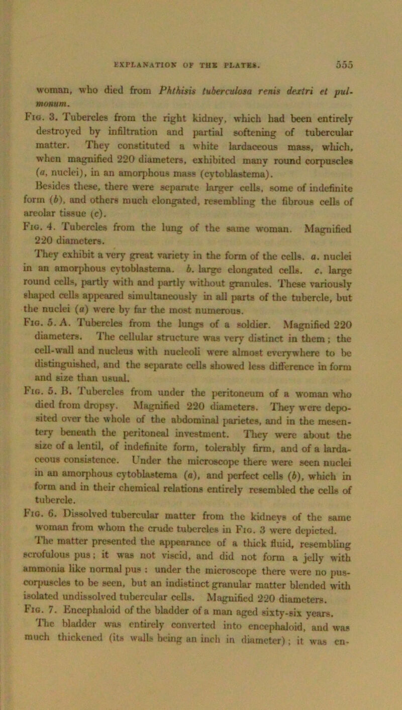 woman, who died from Phthisis tuberculosa rents dextri et pul- monum. Fig. 3. Tubercles from the right kidney, which had been entirely destroyed by infiltration and partial softening of tubercular matter. They constituted a white lardaceous mass, which, when magnified 220 diameters, exhibited manv round corpuscles {a, nuclei), in an amorphous mass (cytohlastema). Besides these, there were separate larger cells, some of indefinite form (b), and others much elongated, resembling the fibrous cells of areolar tissue (c). Fig. 4. Tubercles from the lung of the same woman. Magnified 220 diameters. They exhibit a very great variety in the form of the cells, a. nuclei in an amorphous cytohlastema. b. large elongated cells, c. large round cells, partly with and partly without granules. These variously sliaped cells appeared simultaneously in all parts of the tubercle, but the nuclei (a) were by far the most numerous. Fig. 5. A. Tubercles from the lungs of a soldier. Magnified 220 diameters. The cellular structure was very distinct in them ; the cell-wall and nucleus with nucleoli were almost everywhere to be distinguished, and the separate cells showed less difference in form and size than usual. hiG. 5. B. 1 ubercles from under the peritoneum of a woman who died from dropsy. Magnified 220 diameters. They were depo- sited over the whole of the abdominal parietes, and in the mesen- tery beneath the peritoneal investment. They were about the size of a lentil, of indefinite form, tolerably firm, and of a larda- ceous consistence. I nder the microscope there were seen nuclei in an amorphous cytohlastema (a), and |>erfect cells (b), which in form and in their chemical relations entirely resembled the cells iff tubercle. 1* ig. 6. Dissolved tubercular matter from the kiduevs of the same woman from whom the crude tubercles in Fig. 3 were depicted. 1 he matter presented the appearance of a thick fluid, resembling scrofulous pus; it was not viscid, and did not form a jelly with ammonia like normal pus : under the microscope there were no pus- coqmseles to be seen, but an indistinct granular matter blended with isolated undissolved tubercular cells. Magnified 220 diameters. Fig. 7. Enccphaloid of the bladder of a man aged sixty-six years. The bladder was entirely converted into encephaloid, and was much thickened (its walls being an inch in diameter); it was cn-