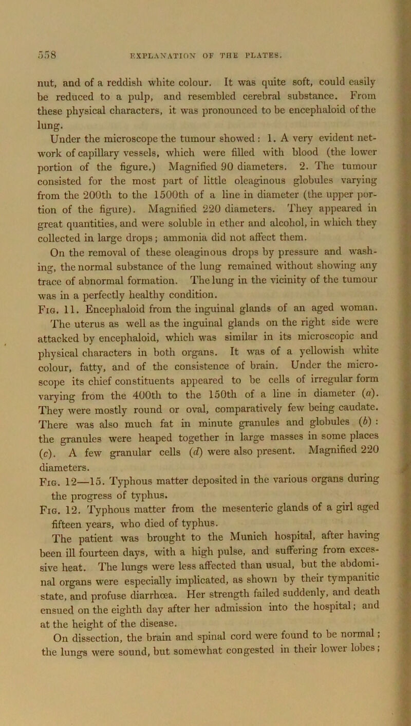 nut, and of a reddish white colour. It was quite soft, could easily be reduced to a pulp, and resembled cerebral substance. From these physical characters, it was pronounced to be encephaloid of the lung. Under the microscope the tumour showed : 1. A very evident net- work of capillary vessels, which were filled with blood (the lower portion of the figure.) Magnified 90 diameters. 2. The tumour consisted for the most part of little oleaginous globules varying from the 200th to the 1500th of a line in diameter (the upper por- tion of the figure). Magnified 220 diameters. They appeared in great quantities, and were soluble in ether and alcohol, in which they collected in large drops; ammonia did not affect them. On the removal of these oleaginous drops by pressure and wash- ing, the normal substance of the lung remained without showing any trace of abnormal formation. The lung in the vicinity of the tumour was in a perfectly healthy condition. Fig. 11. Encephaloid from the inguinal glands of an aged woman. The uterus as well as the inguinal glands on the right side were attacked by encephaloid, which was similar in its microscopic and physical characters in both organs. It was of a yellowish white colour, fatty, and of the consistence of brain. Under the micro- scope its chief constituents appeared to be cells of irregular form varying from the 400th to the 150th of a line in diameter (a). They were mostly round or oval, comparatively few being caudate. There was also much fat in minute granules and globules (6) : the granules were heaped together in large masses in some places (c). A few granular cells (d) were also present. Magnified 220 diameters. Fig. 12—15. Typhous matter deposited in the various organs during the progress of typhus. Fig. 12. Typhous matter from the mesenteric glands of a girl aged fifteen years, who died of typhus. The patient was brought to the Munich hospital, after having been ill fourteen days, with a high pulse, and suffering from exces- sive heat. The lungs were less affected than usual, but the abdomi- nal organs were especially implicated, as shown by their tympanitic state, and profuse diarrhoea. Her strength failed suddenly, and death ensued on the eighth day after her admission into the hospital; and at the height of the disease. On dissection, the brain and spinal cord were found to be normal; the lungs were sound, but somewhat congested in their lower lobes;