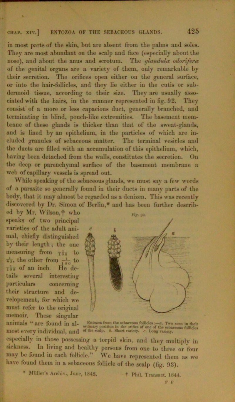 chap, xiv.] ENTOZOA OF THE SEBACEOUS GLANDS. in most parts of the skin, but are absent from the palms and soles. They are most abundant on the scalp and face (especially about the nose), and about the anus and scrotum. The plandula odorifertt of the genital organs are a variety of them, only remarkable by their secretion. The orifices open either on the general surface, or into the hair-follicles, and they lie either in the cutis or sub- dermoid tissue, according to their size. They are usually asso- ciated with the hairs, in the manner represented in fig. 92. They consist of a more or less capacious duct, generally branched, and terminating in blind, pouch-like extremities. The basement mem- brane of these glands is thicker thnn that of the sweat-glands, and is lined by an epithelium, in the particles of which are in- cluded granules of sebaceous matter. The terminal vesicles and the ducts are filled with an accumulation of this epithelium, which, having been detached from the walls, constitutes the secretion. On the deep or parenchymal surface of the basement membrane a web of capillary vessels is spread out. While speaking of the sebaceous glands, we must say a few words of a parasite so generally found in their ducts in many parts of the body, that it may almost be regarded as a denizen. This was recently discovered by Dr. Simon of Berlin,* and has been further describ- ed by Mr. Wilson,-f* who speaks of two principal varieties of the adult ani- mal, chiefly distinguished by their length ; the one measuring from T,(0 to A> the other from ~ to tAar of an inch. He de- tails several interesting particulars concerning their structure and de- velopment, for which we must refer to the original memoir. These singular animals uai e found in al- from the sebaceous follicles -.—a. Two seen in their . , , ordinary position in the orifice of one of the sebaceous follicles most every individual, and of tl“' *call>' *• Short variety. c. Ixmg variety, especially in those possessing a torpid skin, and they multiply in sickness. In living and healthy persons from one to three or four may bo found in each follicle.” We have represented them as we have found them in a sebaceous follicle of the scalp (fig. 93). * M filler's Archiv., June, lb42. + Phil. Transact. 1844.