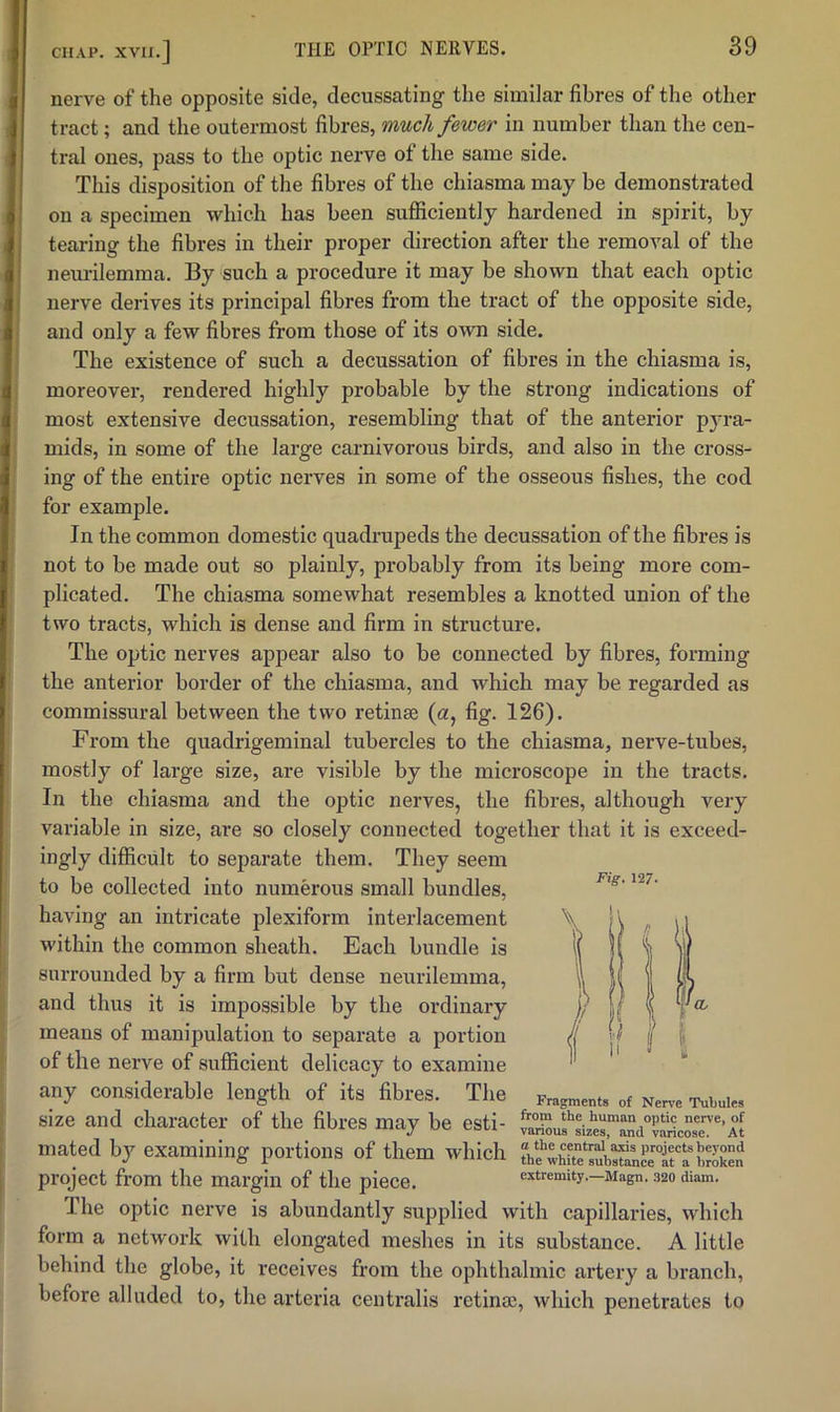 nerve of the opposite side, decussating the similar fibres of the other tract; and the outermost fibres, much fewer in number than the cen- tral ones, pass to the optic nerve of the same side. This disposition of the fibres of the chiasma may be demonstrated on a specimen which has been sufficiently hardened in spirit, by tearing the fibres in their proper direction after the removal of the neurilemma. By such a procedure it may be shown that each optic nerve derives its principal fibres from the tract of the opposite side, and only a few fibres from those of its own side. The existence of such a decussation of fibres in the chiasma is, moreover, rendered highly probable by the strong indications of most extensive decussation, resembling that of the anterior pyra- mids, in some of the large carnivorous birds, and also in the cross- ing of the entire optic nerves in some of the osseous fishes, the cod for example. In the common domestic quadrupeds the decussation of the fibres is not to be made out so plainly, probably from its being more com- plicated. The chiasma somewhat resembles a knotted union of the two tracts, which is dense and firm in structure. The optic nerves appear also to be connected by fibres, forming the anterior border of the chiasma, and which may be regarded as commissural between the two retinse (a, fig. 126). From the quadrigeminal tubercles to the chiasma, nerve-tubes, mostly of large size, are visible by the microscope in the tracts. In the chiasma and the optic nerves, the fibres, although very variable in size, are so closely connected together that it is exceed- ingly difficult to separate them. They seem to be collected into numerous small bundles, having an intricate plexiform inteidacement within the common sheath. Each bundle is surrounded by a firm but dense neurilemma, and thus it is impossible by the ordinary means of manipulation to separate a portion of the nerve of sufficient delicacy to examine any considerable length of its fibres. The Fragment, of Nerve Tutuie, size and character of the fibres may be esti- van“uf:iX“and°?arico,7'’Al mated by examining portions of them which project from the margin of the piece. extremity.—Magn. 320 diam. The optic nerve is abundantly supplied with capillaries, which form a network with elongated meshes in its substance. A little behind the globe, it receives from the ophthalmic artery a branch, before alluded to, the arteria centralis retinse, which penetrates to