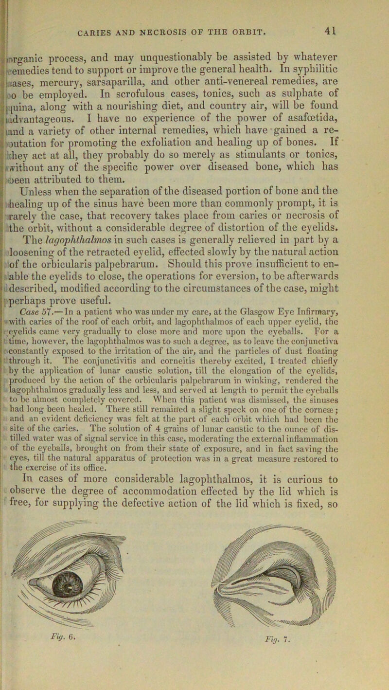 nrganic process, and may unquestionably be assisted by whatever feemedies tend to support or improve the general health. In syphilitic bases, mercury, sarsaparilla, and other anti-venereal remedies, are joo be employed. In scrofulous cases, tonics, such as sulphate of |![uina, along with a nourishing diet, and country air, will be found iidvantageous. I have no experience of the power of asafoetida, land a variety of other internal remedies, which have gained a re- ?outation for promoting the exfoliation and healing up of bones. If ■tdiey act at all, they probably do so merely as stimulants or tonics, dtvithout any of the specific power over diseased bone, which has I (been attributed to them. Unless when the separation of the diseased portion of bone and the healing up of the sinus have been more than commonly prompt, it is I rarely the case, that recovery takes place from caries or necrosis of I the orbit, without a considerable degree of distortion of the eyelids. j The lagophthalmos in such cases is generally relieved in part by a I loosening of the retracted eyelid, elfected slowdy by the natural action of the orbicularis palpebrarum. Should this prove insufficient to en- able the eyelids to close, the operations for eversion, to be afterwards described, modified according to the circumstances of the case, might • perhaps prove useful. Case 57.— In a patient who was under my care, at the Glasgow Eye Infirmary, with caries of the roof of each orbit, and lagophtlialmos of each uj)per eyelid, the eyelids came very gradually to close more and more upon the eyeballs. For a ■ time, however, the lagophthalmos was to such a degree, as to leave the conjunctiva constantly exposed to the irritation of the air, and the particles of dust floating ■ through it. The conjunctivitis and corneitis thereby excited, I treated chiefly by the application of lunar caustic solution, till the elongation of the eyelids, j)roduced by the action of the orbicularis palpebrarum in winking, rendered the lagophthalmos gradually less and less, and served at length to permit the eyeballs to be almost completely covered. When this patient was dismissed, the sinuses had long been healed. There still remaiited a slight speck on one of the cornea;; and an evident deficiency was felt at the part of each orbit which had been the site of the caries. The solution of 4 grains of lunar caustic to the ounce of dis- tilled water was of signal service in this case, moderating the external inflammation of the eyeballs, brought on from their state of exposure, and in fact saving the eyes, till the natural apparatus of protection was in a great measure restored to the exercise of its office. In cases of more considerable lagopbtbalmos, it is curious to observe the degree of accommodation effected by the lid which is free, for supplying the defective action of the lid wdiich is fixed, so