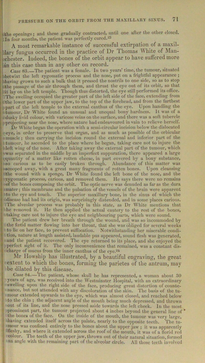 ^ '.the openings; and these gradually contracted, until one after the other closed. ; lln four months, the patient was perfeetly cured. A most remarkable instance of successful extirpation of a maxil- ' llary fungus occurred in tlie practice of Dr Thomas White of Man- j tchester.'’Indeed, the hones of the orbit appear to have suffered more iin this case than in any other on record. J Case 83 The patient was a female. In two years’ time, the tumour, situated \ i'betwixt the left zygomatie process and the nose, put on a frightfid appearance ; i ithaving grown to such a bulk that it pressed the nostrils to one side, so as to stop !the passage of the air through them, and thrust the eye out of its orbit, so that i[:it lay on the left temple. Though thus distorted, the eye still j)crformed its offiee. H j. The swelling occupied the greater part of the left side of the face, extending from 4 \ the lower part of the upper jaw, to the top of the forehead, anil from the farthest sj part of the left temple to the external eanthus of the eye. U])on handling the tumour. Dr White tound an unusual and unequal bony hardness. It was of a t i dusky livid colour, with varicose veins on the surface, and there was a soft tubercle projecting near the nose, where nature had endeavoured in vain to relieve herself. Dr White began the operation with a semi-circular incision below the dislocated i'l 'Cye, in order to preserve that organ, and as much as possible of the orbicular h muscle; then carrying the incision round the external and inferior part of the iit tumour, he ascended to the place where he began, taking care not to injure the left wing of the nose. After taking away the external part of the tumour, which I ‘ was separated in the middle by an imperfect suppuration, there appeared a large I' quantity of a matter like rotten cheese, in part covered by a bony substance, i so carious as to be easily broken through. Abundance of this matter was 1s«cooped away, with a great many fragments of rotten bones. Upon cleansing '.the wound with a sponge. Dr White found the left bone of the nose, and the zygomatic process, carious, and removed them. He says there were no remains 5 of the bones composing the orbit. The ojitic nerve was denuded as far as the dura I imater; this membrane and the pulsation of the vessels of the brain were apparent ■ to the eye and touch. The superior maxillary bone, in the sinus of whieh the idisease had had its origin, was surprisingly distended, and in some places carious. I The alveolar process was probably in this state, as Dr White mentions that he removed it. He then applied the aetual cautery to the rest of the bones, taking care not to injure the eye and neighbouring parts, which were sound. The ])atient drew her breath through the wound, and was so incommoded by the fietid matter (lowing into her throat, that she was obliged for several weeks to lie on her face, to j)revent suftbeation. Notwithstanding her miserable condi- tion, nature at length assisted, laudable pus appeared, sound flesh was generated, and the patient recovered. The eye returned to its place, and she enjoyed the perfect sight of it. The only inconvenience that remained, was a constant dis- charge of mucus from the inner eanthus of the eye.'-^* Mr Howship has illustrated, by a beautiful engraving, the great extent to wbicb the bones, forming the parietes of the antrum, may be dilated by this disease. Case 84.—The patient, whose skull he has represented, a woman about 30 years of age, was received into the Westminster Hospital, with an extraordinary I swelling upon the right side of the face, producing great distortion of counte- nance, but not attended with any discoloration of the skin. The basis of the tu- mour extended uj)wards to the eye, whieh was almost closed, and reaehed below to the chin ; the adjacent angle of the mouth being much depressed, and thrown t out of its line, and the nose pressed aside towards the left cheek. In the most ( prominent part, the tumour projected about 4 inches beyond the general line of * ' the bones of the face. On the inside of the mouth, the tumour was very large, ' having extended itself across the palate, nearly to the opposite teeth. The tu- t :imour was confined entirely to the bones about the upper jaw ; it was apparently 5 .fleshy, and where it extended across the roof of the mouth, it was of a florid red ; colour. The teeth of the upper jaw, thrown out of their natural situation, formed ' an angle with the remaining jiart of the alveolar circle. All those teeth involved