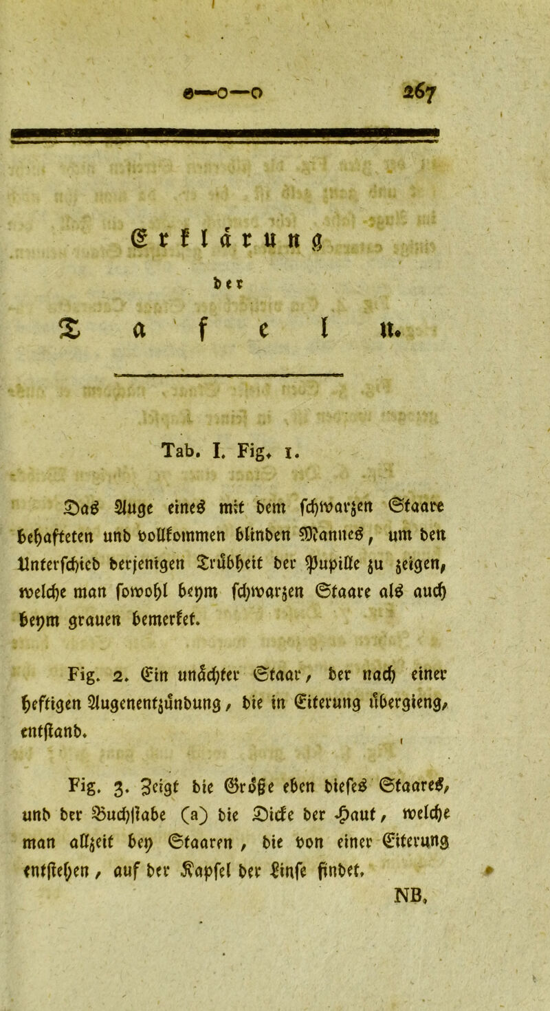 I e—o—o 267 (grfldrung bet X a ' f c l n. Tab. I# Fig* 1. £)a$ 2Juge eine$ mit bem fchmarjen (Staate Behafteten unb bollfommen blinben $?anne£, um ben Unterfchtcb berjentgen £vubfjett bet <pupiöe $u geigen, welche man fomofjl bet)m fd;war$en ©taare al$ auch bepm grauen bemerket. Fig. 2. <£in unechter ©taar, ber ttad) einer heftigen 2lugenent$unbung, bie in Eiterung ilbergieng, entfianb* Fig. 3. 3eigt bie 0ro§e eben biefeä ©taare#, unb ber $5ud)|Iabe (a) bie £>irfe ber *£>aut, welche man allzeit bet> ©faaren , bie bon einer Eiterung entgehen, auf ber Äapfel ber &nfe fünbet, NB,