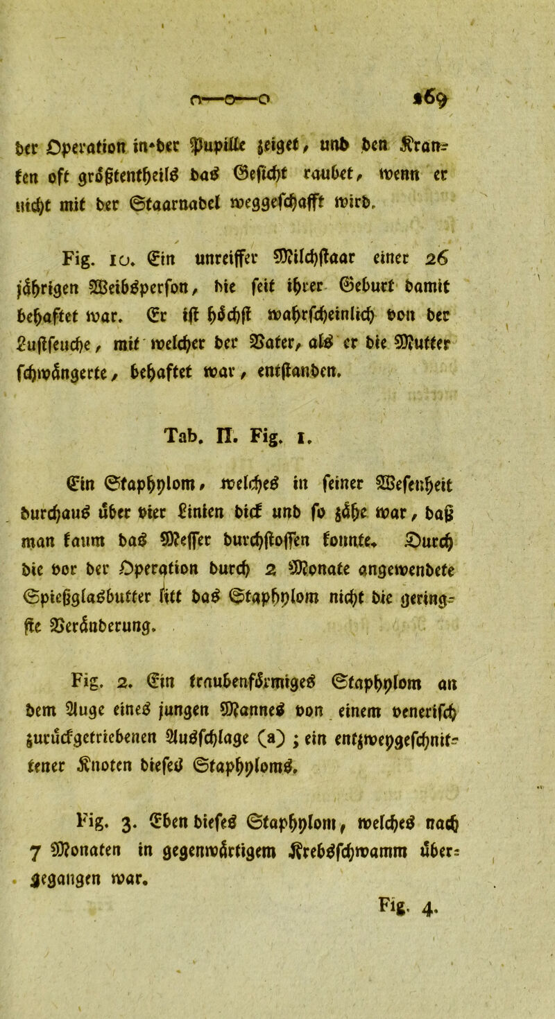 o—o—o t6^ ber Operation in*ber ^Pupille zeiget, und ben $ran? Un oft grogtent&eitö ba$ 0efid)t raubet, wenn er md>t mit ber 6taarnabel weggefdjafft wirb, Fig. io* (Etn unreiffer $?ild)gaar einer 26 j&jrigen 2Beib$perfon, Me feit i&rer 0eburt bamit behaftet war. 0r ijf wafjrfdjeinlid) bon ber 2u|tfeud)e , mit welker ber 2kter, al£ er bie Puffer fdjwängerte , behaftet war, entftanben. Tab. II. Fig. 1. (Ein @fap&plonw welcf>e$ in feiner £8efenijeit burc^au^ über hier Linien bi<f unb fo $ä(je war , baj* man faum bag 9)?effer burd$ojfen fonnte, £)urd) bie bor ber Operation burd) 2 Monate angewenbefe ©picßgia^butfer fttt ba$ (^tapbploro nid)t bie gering- ffe 2>er<Snberung. Fig. 2, (Ein fraubenf&migeä ©tapbplom an bem 2Juge eineä jungen 9)?anne$ bon einem benerifcb $urücfgetriebenen 5lu$fd)lage (a) ; ein enf$wepgefcbnif^ tener knoten biefetf ©tapbpfom&. Fig. 3. (Ebenbiefeä ©tapbplom, mld)e$ nacfc 7 Monaten in gegenwärtigem Ärebtffcbwamm tfber= gegangen war. Fig. 4.