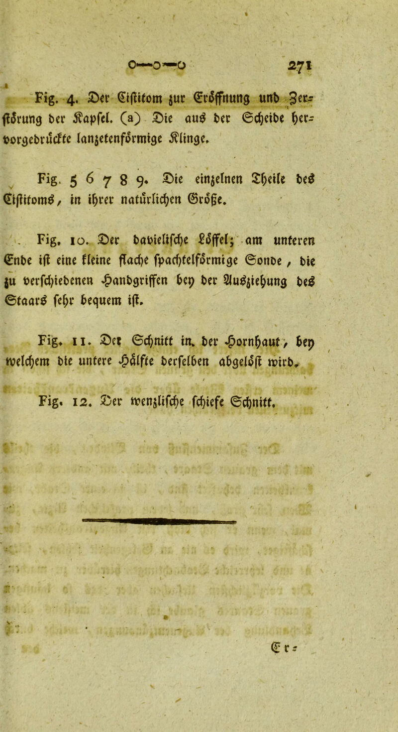 0—0—0 27* M Fig. 4, £er Giffttom $ur Öffnung unb get- ffSrung bet* $apfcl. (a) £)ie au$ ber ©cheibe ^cr- twrgebrutfte lan$etenformtge klinge, Fig. 5 6 7 8 9« £)ie einzelnen ^cile be$ (Sijlifom£, in natürlichen ©roge. Fig, 10. £>ec babielifdje Riffel; am unteren ©nbe ijt eine fleine flache fpad)telformige ©otibe, bie $u t>erfd;iebenen £anbgriffen bep bei* 2Ju$$iehung beg ©taarS fehl* bequem i|f. \ Fig* 11* £)et ©chnitt in. bei* Hornhaut; bep welchem bie untere £4lfte berfelben abgeloß wirb* Fig. 12. £er Wen$lifche fchiefe ©chnitf.