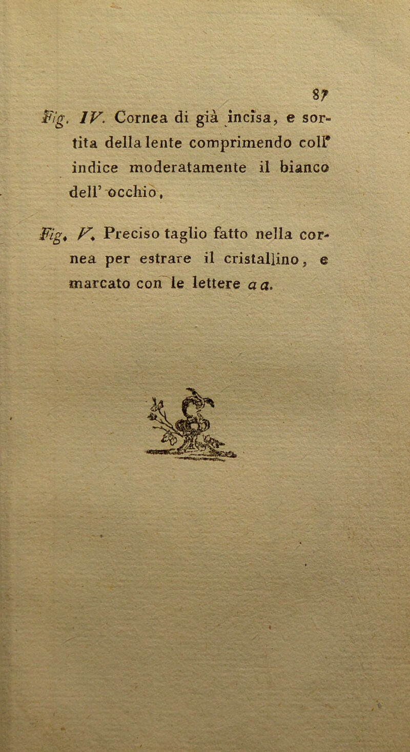 8^ Fig, IV. Cornea di già incisa, e sor* tita della lente comprimendo coll* indice moderatamente il bianco deir occhio, Vig^ Preciso taglio fatto nella cor- nea per estrare il cristallino, e marcato con le lettere a a»
