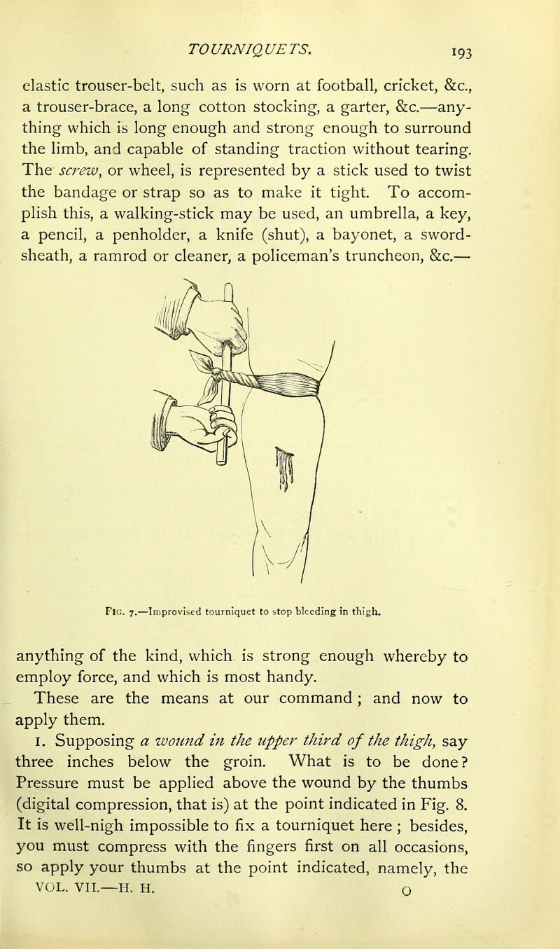 TOURNIQUETS. elastic trouser-belt, such as is worn at football, cricket, &c., a trouser-brace, a long cotton stocking, a garter, &c.—any- thing which is long enough and strong enough to surround the limb, and capable of standing traction without tearing. The screw, or wheel, is represented by a stick used to twist the bandage or strap so as to make it tight. To accom- plish this, a walking-stick may be used, an umbrella, a key, a pencil, a penholder, a knife (shut), a bayonet, a sword- sheath, a ramrod or cleaner, a policeman’s truncheon, &c.— Fig. 7.—Improvised tourniquet to stop bleeding in thigh. anything of the kind, which, is strong enough whereby to employ force, and which is most handy. These are the means at our command ; and now to apply them. I. Supposing a wotmd in the upper third of the thigh, say three inches below the groin. What is to be done ? Pressure must be applied above the wound by the thumbs (digital compression, that is) at the point indicated in Fig. 8. It is well-nigh impossible to fix a tourniquet here ; besides, you must compress with the fingers first on all occasions, so apply your thumbs at the point indicated, namely, the