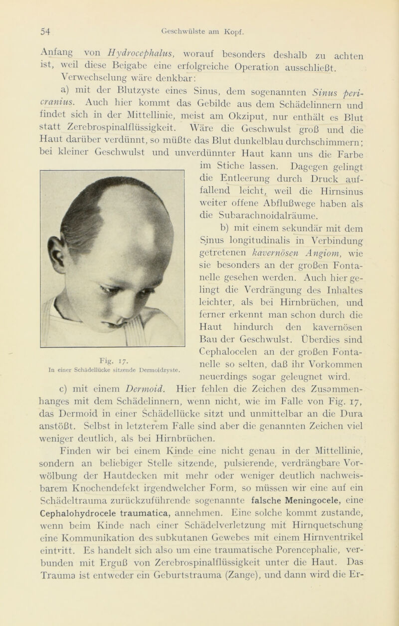 Anfang \ on Hydvoccphcilus, worauf besonders deshalb zu achten ist, weil diese Beigabe eine erfolgreiche Operation ausschließt. Verwechselung wäre denkbar: a) mit der Blutzyste eines Sinus, dem sogenannten Sinus peri- cranius. Auch hier kommt das Gebilde aus dem Schädelinnern und findet sich in der Mittellinie, meist am Okziput, nur enthält es Blut statt Zerebrospinalflüssigkeit. Wäre die Geschwulst groß und die Haut darüber verdünnt, so müßte das Blut dunkelblau durchschimmern; bei kleiner Geschwulst und unverdünnter Haut kann uns die Farbe im Stiche lassen. Dagegen gelingt die Entleerung durch Druck auf- fallend leicht, weil die Hirnsinus weiter offene Abflußwege haben als die Subarachnoidalräume. b) mit einem sekundär mit dem Sinus longitudinalis in Verbindung getretenen kavernösen Angiom, wie sie besonders an der großen Fonta- nelle gesehen werden. Auch hier ge- lingt die Verdrängung des Inhaltes leichter, als bei Hirnbrüchen, und ferner erkennt man schon durch die Haut hindurch den kavernösen Bau der Geschwulst. Überdies sind Cephalocelen an der großen Fonta- nelle so selten, daß ihr Vorkommen neuerdings sogar geleugnet wird, c) mit einem Dermoid. Hier fehlen die Zeichen des Zusammen- hanges mit dem Schädelinnern, wenn nicht, wie im Falle von Fig. 17, das Dermoid in einer Schädellücke sitzt und unmittelbar an die Dura anstößt. Selbst in letzterem Falle sind aber die genannten Zeichen viel weniger deutlich, als bei Hirnbrüchen. Finden wir bei einem Kinde eine nicht genau in der Mittellinie, sondern an beliebiger Stelle sitzende, pulsierende, verdrängbare Vor- wölbung der Hautdecken mit mehr oder weniger deutlich nachweis- barem Knochendefekt irgendwelcher Form, so müssen wir eine auf ein Schädeltrauma zurückzuführende sogenannte falsche Meningocele, eine Cephalohydrocele traumatica, annehmen. Eine solche kommt zustande, wenn beim Kinde nach einer Schädelverletzung mit Hirnquetschung eine Kommunikation des subkutanen Gewebes mit einem Hirnventrikel eintritt. Es handelt sich also um eine traumatische Porencephalie, ver- bunden mit Erguß von Zerebrospinalflüssigkeit unter die Haut. Das Trauma ist entweder ein Geburtstrauma (Zange), und dann wird die Er- Fig. 17. In einer Schädellücke sitzende Dermoidzyste.
