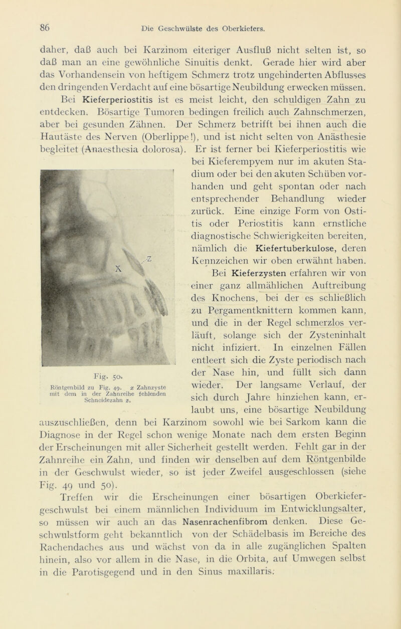 daher, daß auch bei Karzinom eiteriger Ausfluß nicht selten ist, so daß man an eine gewöhnliche Sinuitis denkt. Gerade hier wird aber das Vorhandensein von heftigem Schmerz trotz ungehinderten Abflusses den dringenden Verdacht auf eine bösartige Neubildung erwecken müssen. Bei Kieferperiostitis ist es meist leicht, den schuldigen Zahn zu entdecken. Bösartige Tumoren bedingen freilich auch Zahnschmerzen, aber bei gesunden Zähnen. Der Schmerz betrifft bei ihnen auch die Hautäste des Nerven (Oberlippe!), und ist nicht selten von Anästhesie begleitet (Anaesthesia dolorosa). Er ist ferner bei Kieferperiostitis wie bei Kieferempyem nur im akuten Sta- dium oder bei den akuten Schüben vor- handen und geht spontan oder nach entsprechender Behandlung wieder zurück. Eine einzige Form von Osti- tis oder Periostitis kann ernstliche diagnostische Schwierigkeiten bereiten, nämlich die Kiefertuberkulose, deren Kennzeichen wir oben erwähnt haben. Bei Kieferzysten erfahren wir von einer ganz allmählichen Auftreibung des Knochens, bei der es schließlich zu Pergamentknittern kommen kann, und die in der Regel schmerzlos ver- läuft, solange sich der Zysteninhalt nicht infiziert. In einzelnen Fällen entleert sich die Zyste periodisch nach der Nase hin, und füllt sich dann wieder. Der langsame Verlauf, der sich durch Jahre hinziehen kann, er- laubt uns, eine bösartige Neubildung auszuschließen, denn bei Karzinom sowohl wie bei Sarkom kann die Diagnose in der Regel schon wenige Monate nach dem ersten Beginn der Erscheinungen mit aller Sicherheit gestellt werden. Fehlt gar in der Zahnreihe ein Zahn, und finden wir denselben auf dem Röntgenbilde in der Geschwulst wieder, so ist jeder Zweifel ausgeschlossen (siehe Fig. 49 und 50). Treffen wir die Erscheinungen einer bösartigen Oberkiefer- geschwulst bei einem männlichen Individuum im Entwicklungsalter, so müssen wir auch an das Nasenrachenfibrom denken. Diese Ge- schwulstform geht bekanntlich von der Schädelbasis im Bereiche des Rachendaches aus und wächst von da in alle zugänglichen Spalten hinein, also vor allem in die Nase, in die Orbita, auf Umwegen selbst in die Parotisgegend und in den Sinus maxillaris: Fig- 50. Röntgenbild zu Fig. 49. x Zahnzyste mit dem in der Zahnreihe fehlenden Schneidezahn z.