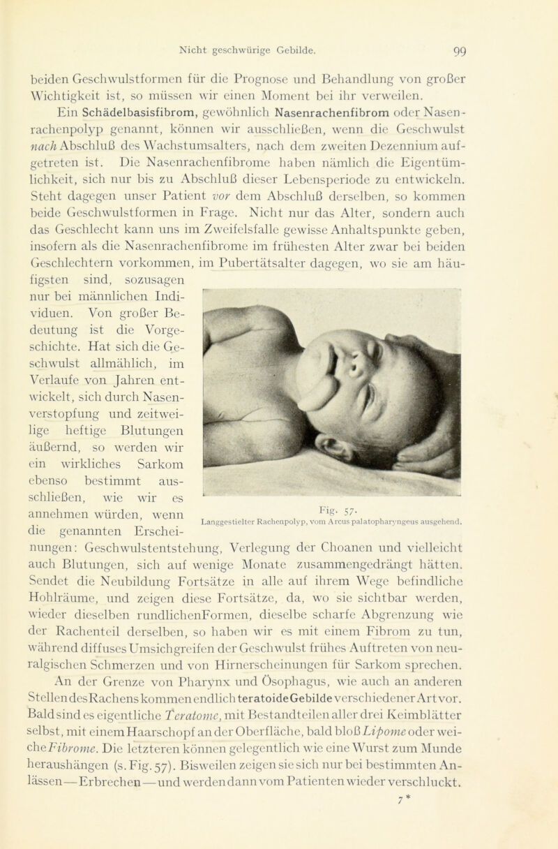 beiden Geschwulstformen für die Prognose und Behandlung von großer Wichtigkeit ist, so müssen wir einen Moment bei ihr verweilen. Ein Schädelbasisfibrom, gewöhnlich Nasenrachenfibrom oder Nasen- rachenpolyp genannt, können wir ausschließen, wenn die Geschwulst nach Abschluß des Wachstumsalters, nach dem zweiten Dezennium auf- getreten ist. Die Nasenrachenfibrome haben nämlich die Eigentüm- lichkeit, sich nur bis zu Abschluß dieser Lebensperiode zu entwickeln. Steht dagegen unser Patient vor dem Abschluß derselben, so kommen beide Geschwulstformen in Frage. Nicht nur das Alter, sondern auch das Geschlecht kann uns im Zweifelsfalle gewisse Anhaltspunkte geben, insofern als die Nasenrachenfibrome im frühesten Alter zwar bei beiden Geschlechtern Vorkommen, im Pubertätsalter dagegen, wo sie am häu- figsten sind, sozusagen nur bei männlichen Indi- viduen. Von großer Be- deutung ist die Vorge- schichte. Hat sich die Ge- schwulst allmählich, im Verlaufe von Jahren ent- wickelt, sich durch Nasen- verstopfung und zeitwei- lige heftige Blutungen äußernd, so werden wir ein wirkliches Sarkom ebenso bestimmt aus- schließen, wie wir es annehmen würden, wenn Laaggestielter Rachenpolyp, vom Arcus palatopharyngeus ausgehend. die genannten Erschei- nungen: Geschwulstentstehung, Verlegung der Choancn und vielleicht auch Blutungen, sich auf wenige Monate zusammengedrängt hätten. Sendet die Neubildung Fortsätze in alle auf ihrem Wege befindliche Hohlräume, und zeigen diese Fortsätze, da, wo sie sichtbar werden, wieder dieselben rundlichenFormen, dieselbe scharfe Abgrenzung wie der Rachenteil derselben, so haben wir es mit einem Fibrom zu tun, während diffuses Umsichgreifen der Geschwulst frühes Auftreten von neu- ralgischen Schmerzen und von Hirnerscheinungen für Sarkom sprechen. An der Grenze von Pharynx und Ösophagus, wie auch an anderen Stellen desRachens kommen endlich teratoide Gebilde verschiedener Art vor. Bald sind es eigentliche Teratome, mit Bestandteilen aller drei Keimblätter selbst, mit einem Haarschopf an der Oberfläche, bald bloß Lipome oder wei- cheFibrome. Die letzteren können gelegentlich wie eine Wurst zum Munde heraushängen (s. Fig. 57). Bisweilen zeigen sie sich nur bei bestimmten An- lässen—Erbrechen—und werden dann vom Patienten wieder verschluckt. 7*