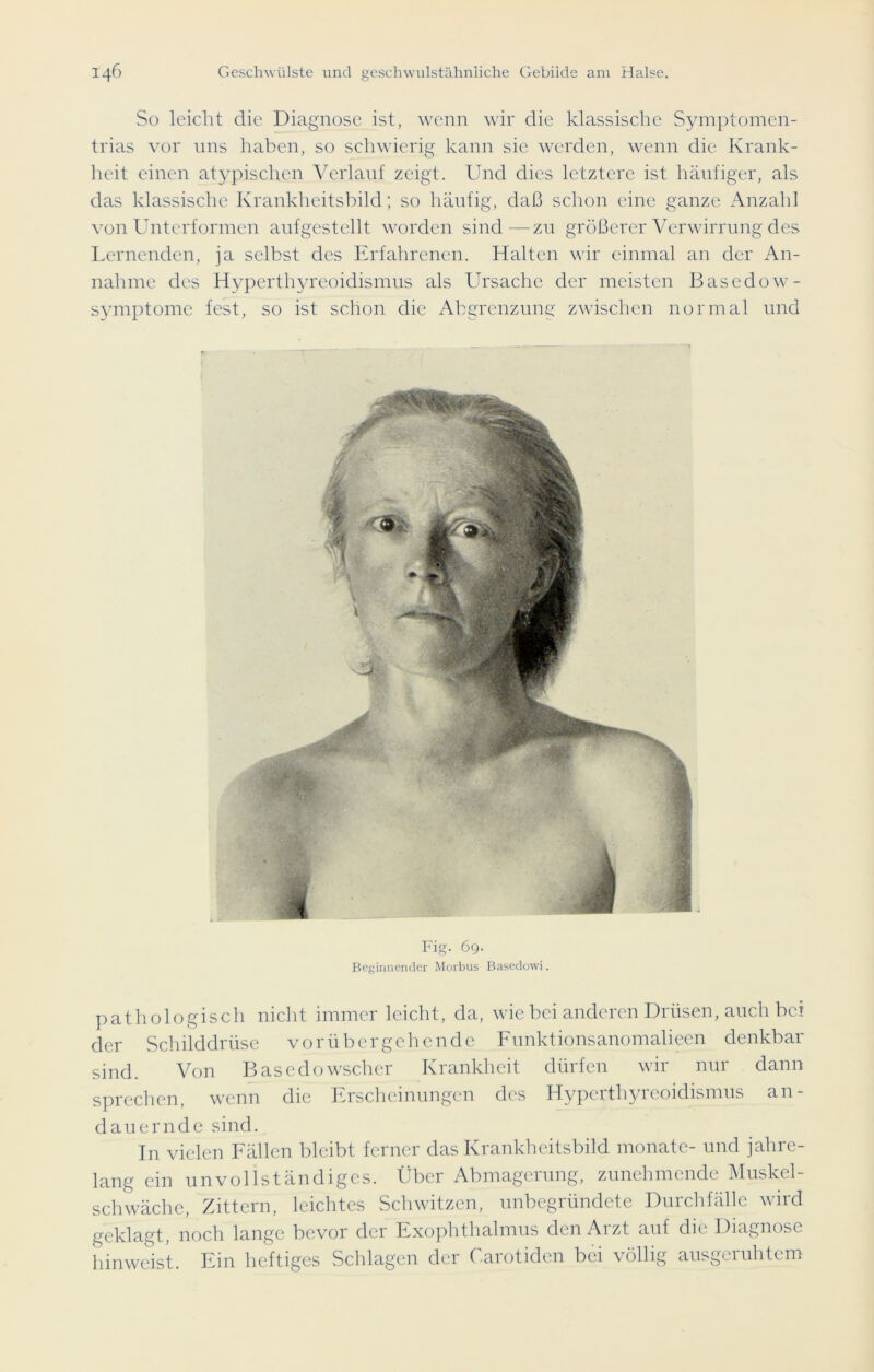 So leicht clie Diagnose ist, wenn wir die klassische Symptomen- trias vor uns haben, so schwierig kann sie werden, wenn die Krank- heit einen atypischen Verlauf zeigt. Und dies letztere ist häufiger, als das klassische Krankheitsbild; so häufig, daß schon eine ganze Anzahl von Unterformen aufgestellt worden sind—zu größerer Verwirrung des Lernenden, ja selbst des Erfahrenen. Halten wir einmal an der An- nahme des Hyperthyreoidismus als Ursache der meisten Basedow- Symptome fest, so ist schon die Abgrenzung zwischen normal und Fig. 69. Beginnender Morbus Basedowi. pathologisch nicht immer leicht, da, wie bei anderen Drüsen, auch bei der Schilddrüse vorübergehende Funktionsanomalieen denkbar sind. Von Basedowscher Krankheit dürfen wir nur dann sprechen, wenn die Erscheinungen des Hyperthyreoidismus an- dauernde sind. In vielen Fällen bleibt ferner das Krankheitsbild monate- und jahre- lang ein unvollständiges. Über Abmagerung, zunehmende Muskel- schwäche, Zittern, leichtes Schwitzen, unbegründete Durchfälle wird geklagt, noch lange bevor der Exophthalmus den Arzt auf die Diagnose hinweist. Ein heftiges Schlagen der Carotiden bei völlig ausgeruhtem