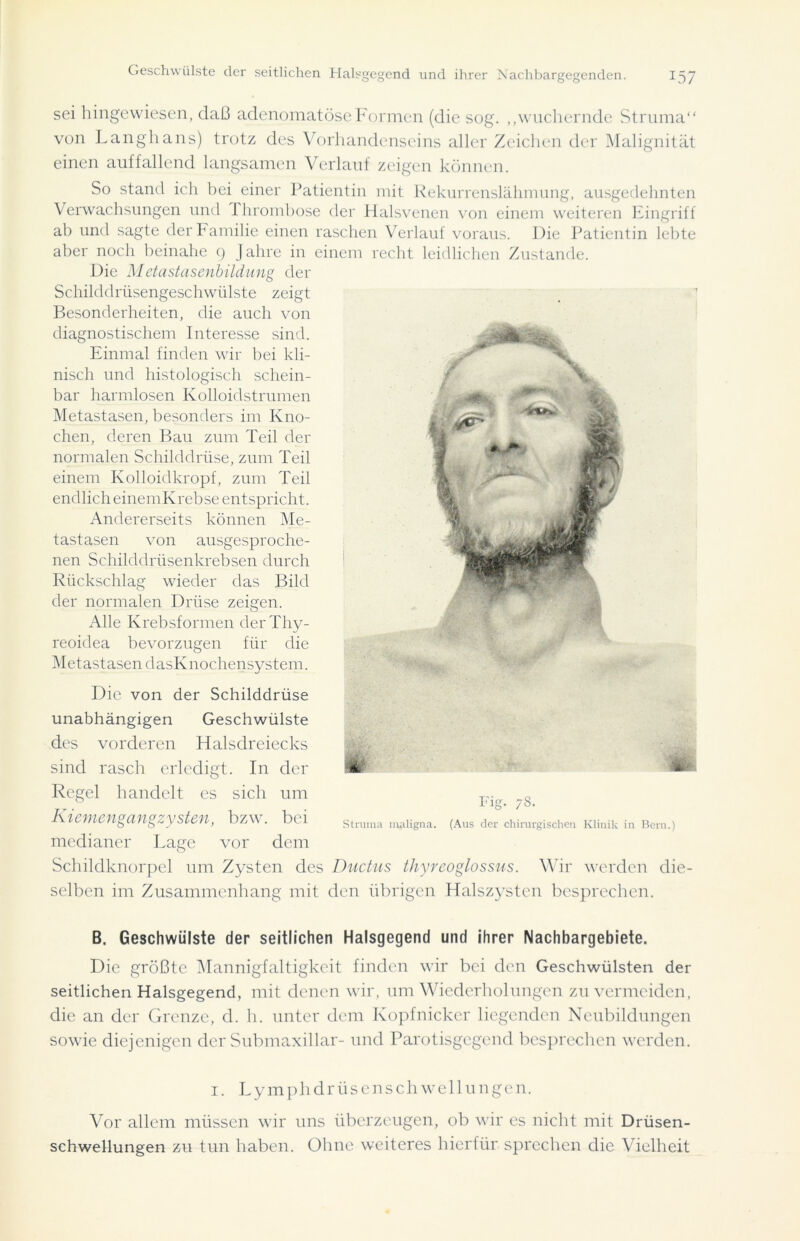 Geschwülste der seitlichen Halsgegend und ihrer Nachbargegenden. sei hingewiesen, daß adenomatöse Formen (die sog. „wuchernde Struma“ von Langhans) trotz des Vorhandenseins aller Zeichen der Malignität einen auffallend langsamen Verlauf zeigen können. So stand ich bei einer Patientin mit Rekurrenslähmung, ausgedehnten Verwachsungen und 1 hrombose der Halsvenen von einem weiteren Eingriff ab und sagte der Familie einen raschen Verlauf voraus. Die Patientin lebte aber noch beinahe 9 Jahre in einem recht leidlichen Zustande. Die Metastasenbildung der Schilddrüsengeschwülste zeigt Besonderheiten, die auch von diagnostischem Interesse sind. Einmal finden wir bei kli- nisch und histologisch schein- bar harmlosen Kolloidstrumen Metastasen, besonders im Kno- chen, deren Bau zum Teil der normalen Schilddrüse, zum Teil einem Kolloidkropf, zum Teil endlich einemKrebse entspricht. Andererseits können Me- tastasen von ausgesproche- nen Schilddrüsenkrebsen durch Rückschlag wieder das Bild der normalen Drüse zeigen. Alle Krebsformen der Thy- reoidea bevorzugen für die Metastasen dasKnochensystem. Die von der Schilddrüse • -7 ilJl TjjLL m-. unabhängigen des vorderen sind rasch Regel handelt erledigt Geschwülste Halsdreiecks In der es sich um Fig. 78. Struma maligna. (Aus der chirurgischen. Klinik in Bern.) Kiemengangzysten, bzw. bei medianer Lage vor dem Schildknorpel um Zysten des Ductus thyreoglossus. Wir werden die- selben im Zusammenhang mit den übrigen Halszysten besprechen. B. Geschwülste der seitlichen Halsgegend und ihrer Nachbargebiete. Die größte Mannigfaltigkeit finden wir bei den Geschwülsten der seitlichen Halsgegend, mit denen wir, um Wiederholungen zu vermeiden, die an der Grenze, d. h. unter dem Kopfnicker liegenden Neubildungen sowie diejenigen der Submaxillar- und Parotisgegend besprechen werden. 1. Ly mph dr üsensch well ungen. Vor allem müssen wir uns überzeugen, ob wir cs nicht mit Drüsen- schwellungen zu tun haben. Ohne weiteres hierfür sprechen die Vielheit